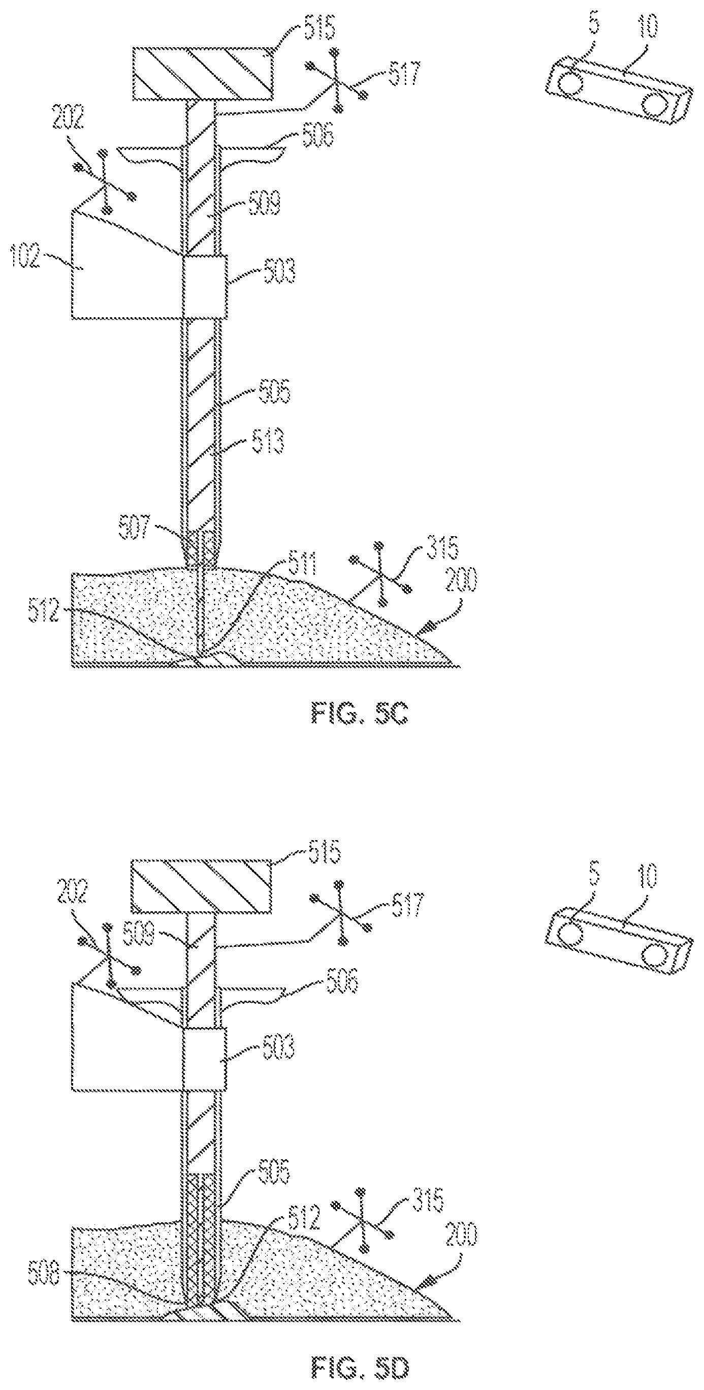 Patent US12102394 Figure 10 – Multi-stage dilator and cannula system and method