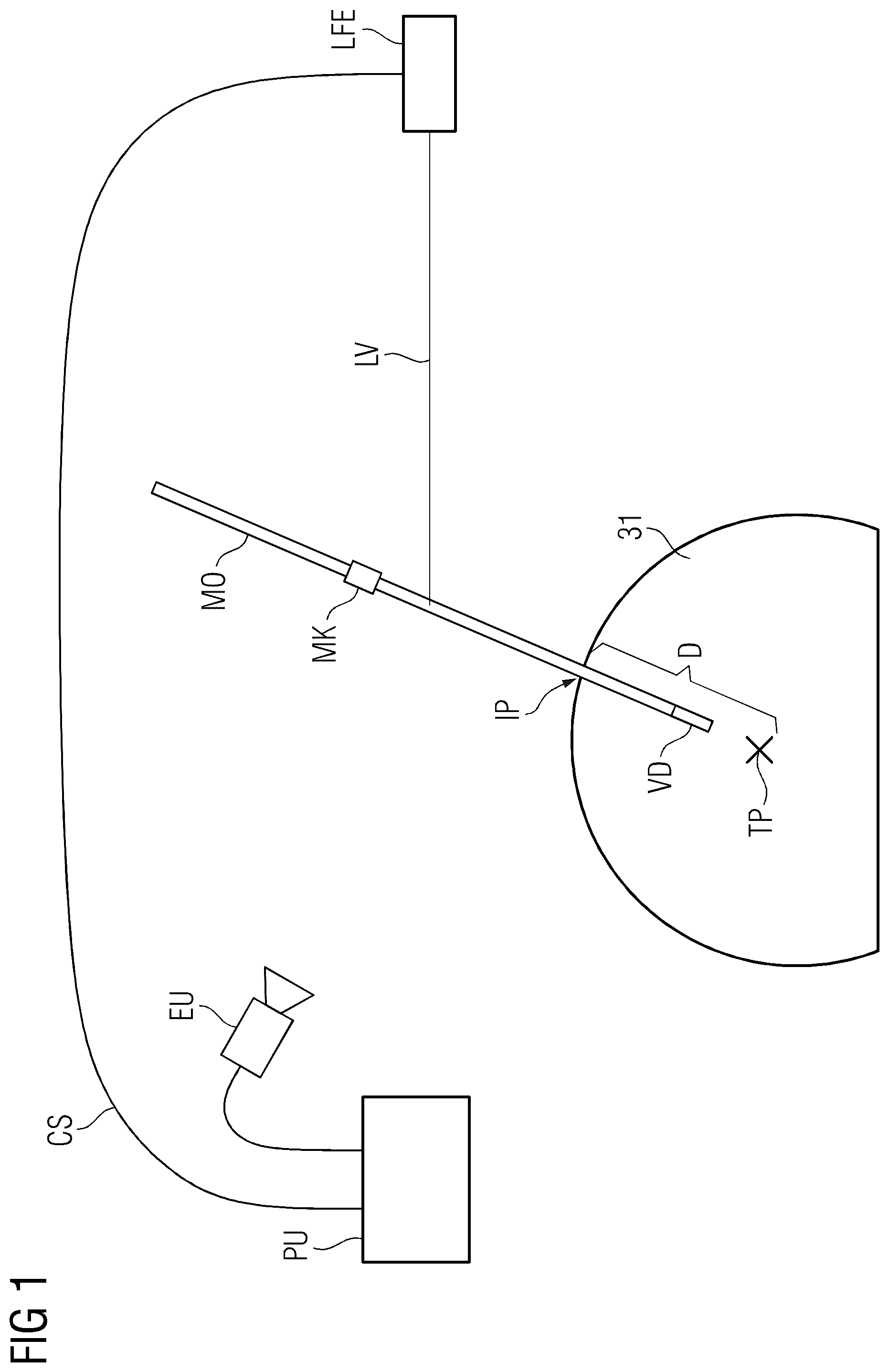 Patent US12102395 Figure 1 – System for positioning a medical object at a desired depth and method for emitting a light distribution