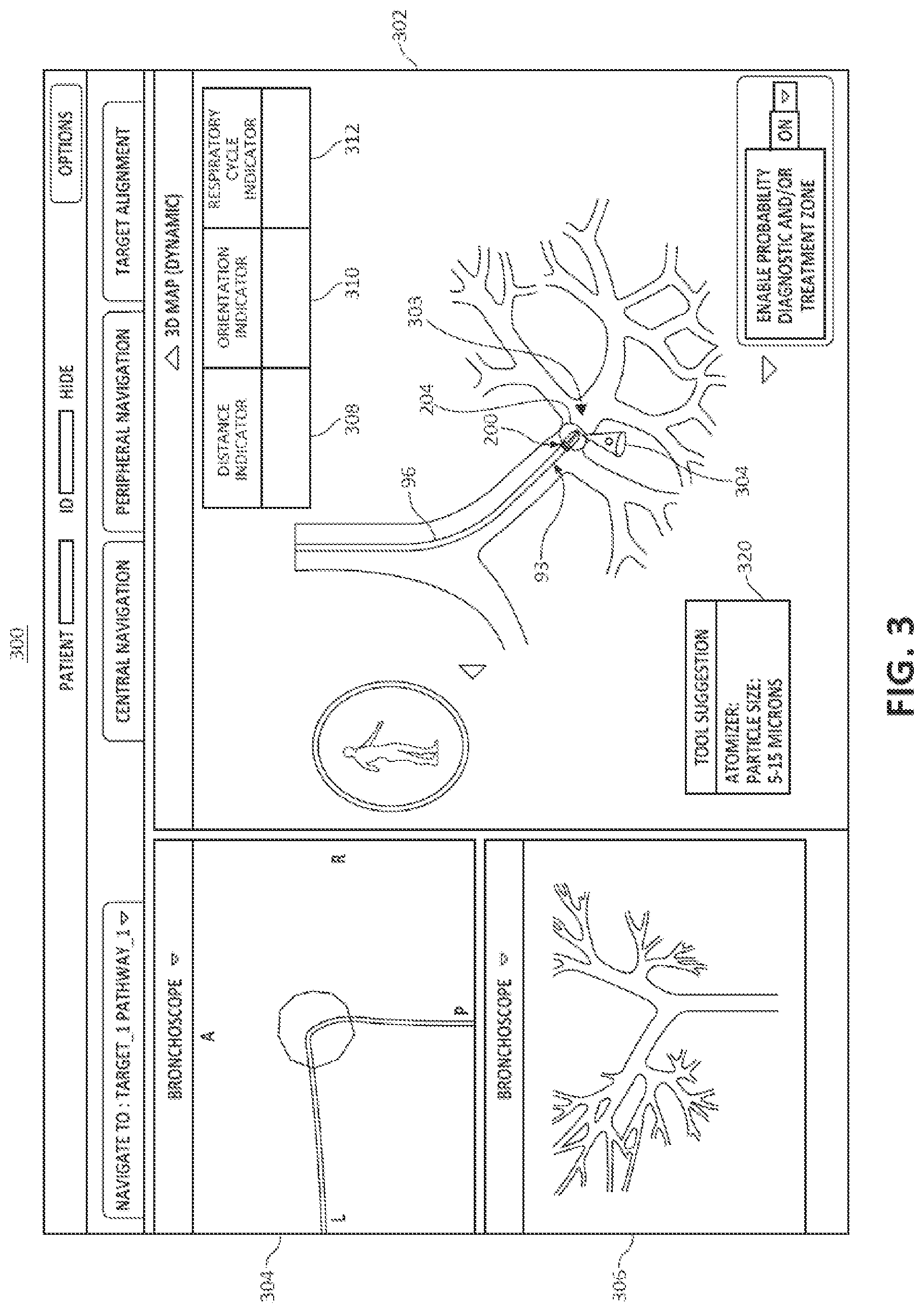 Patent US12102396 Figure 3 – Systems and methods for navigational bronchoscopy and selective drug delivery