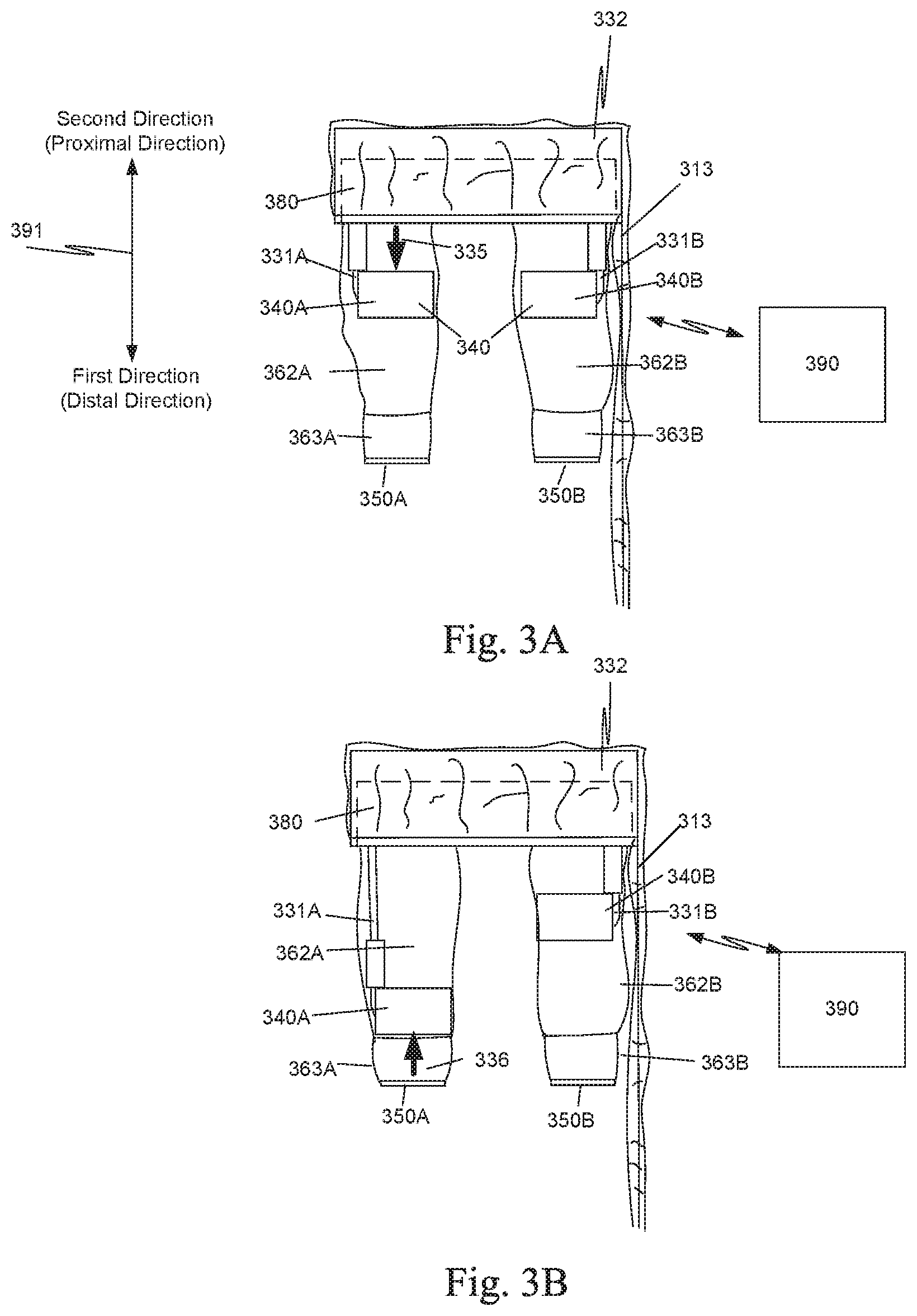 Patent US12102400 Figure 3 – Techniques for controlling a moveable component