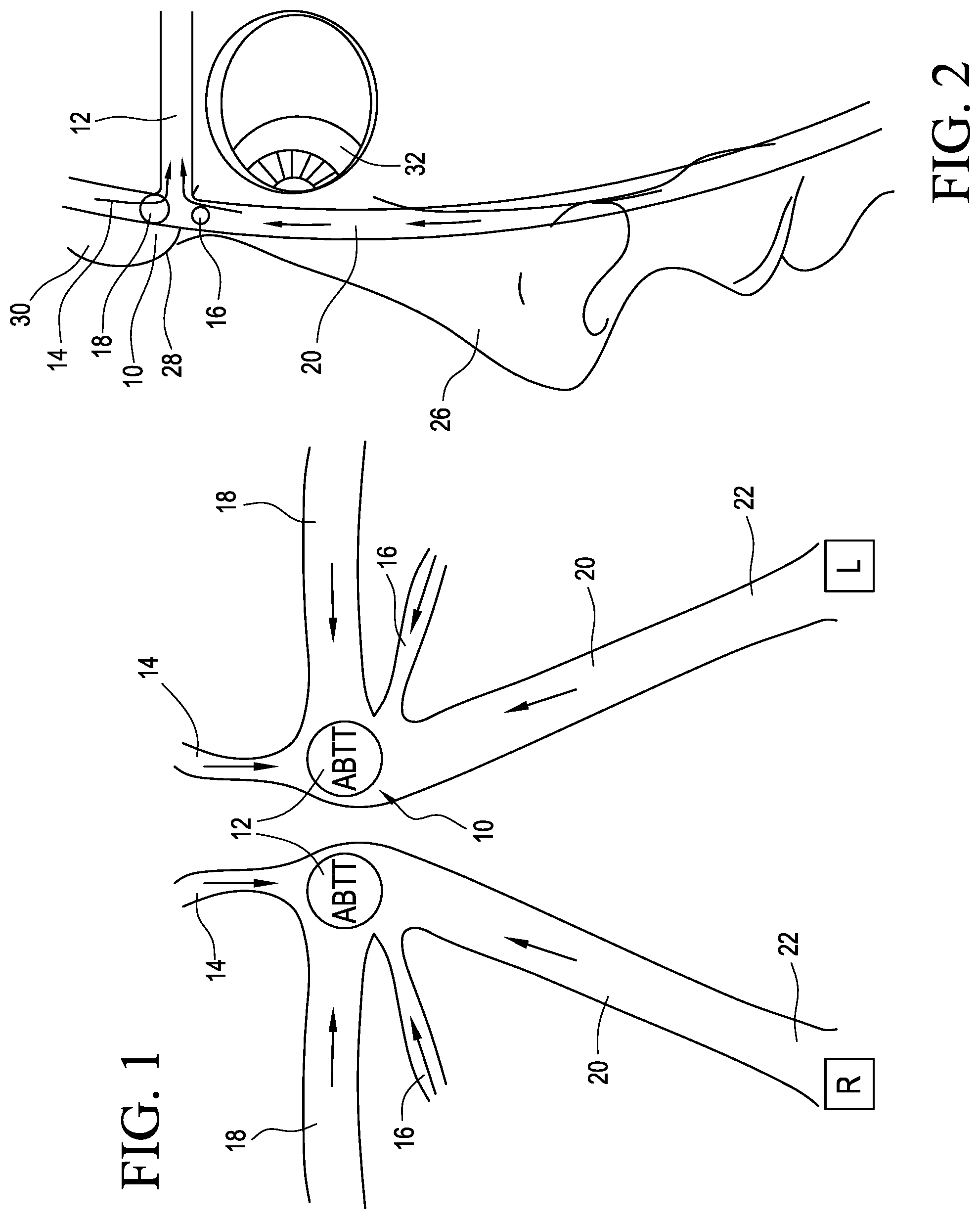 Patent US12102413 Figure 1 – Devices for measuring temperature of an ABTT terminus