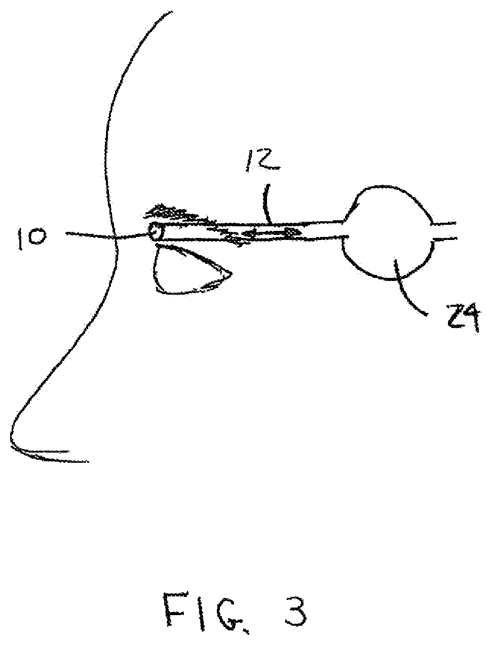 Patent US12102413 Figure 2 – Devices for measuring temperature of an ABTT terminus