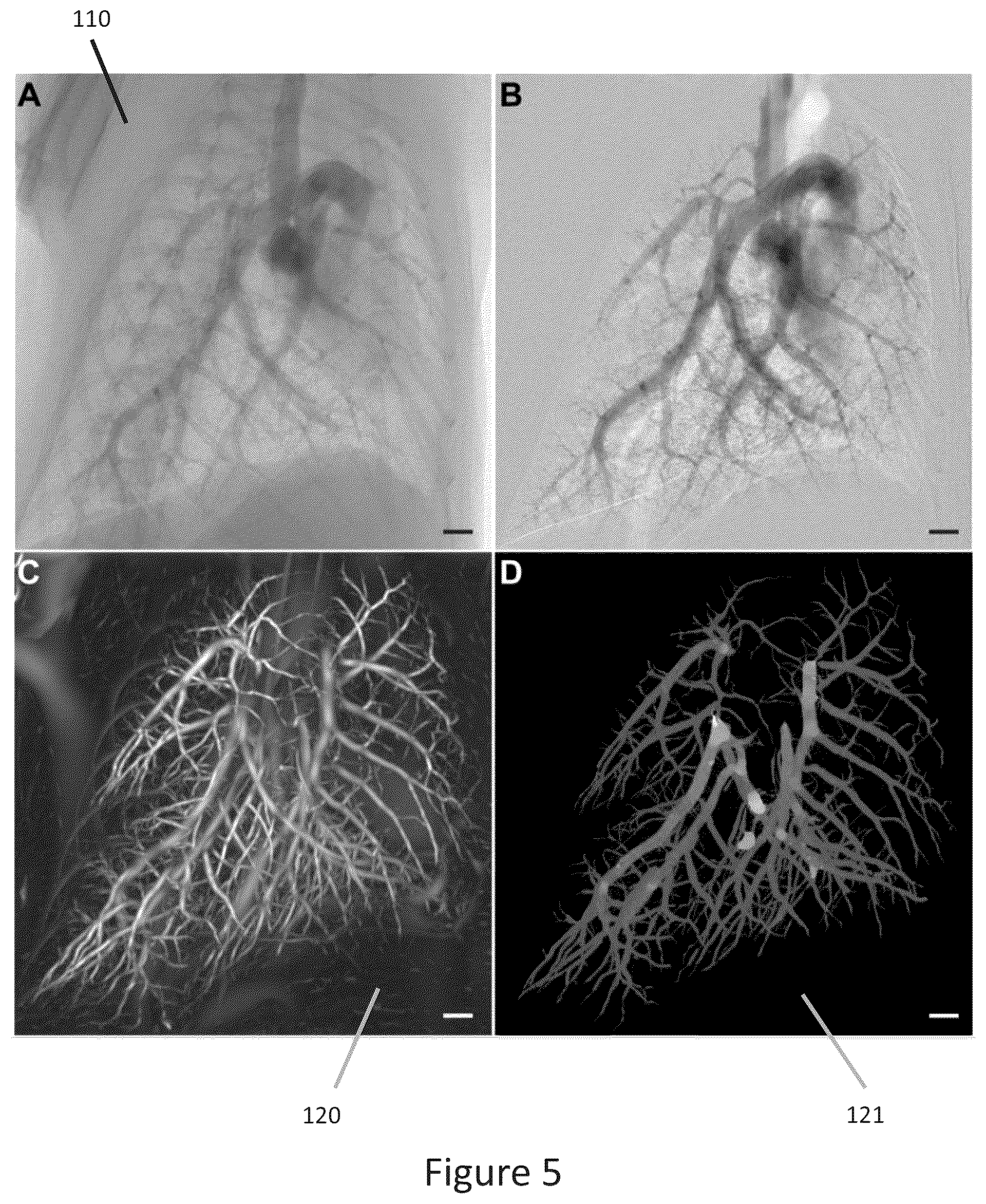 Patent US12102414 Figure 3 – Method of scanning and assessing lung and vascular health