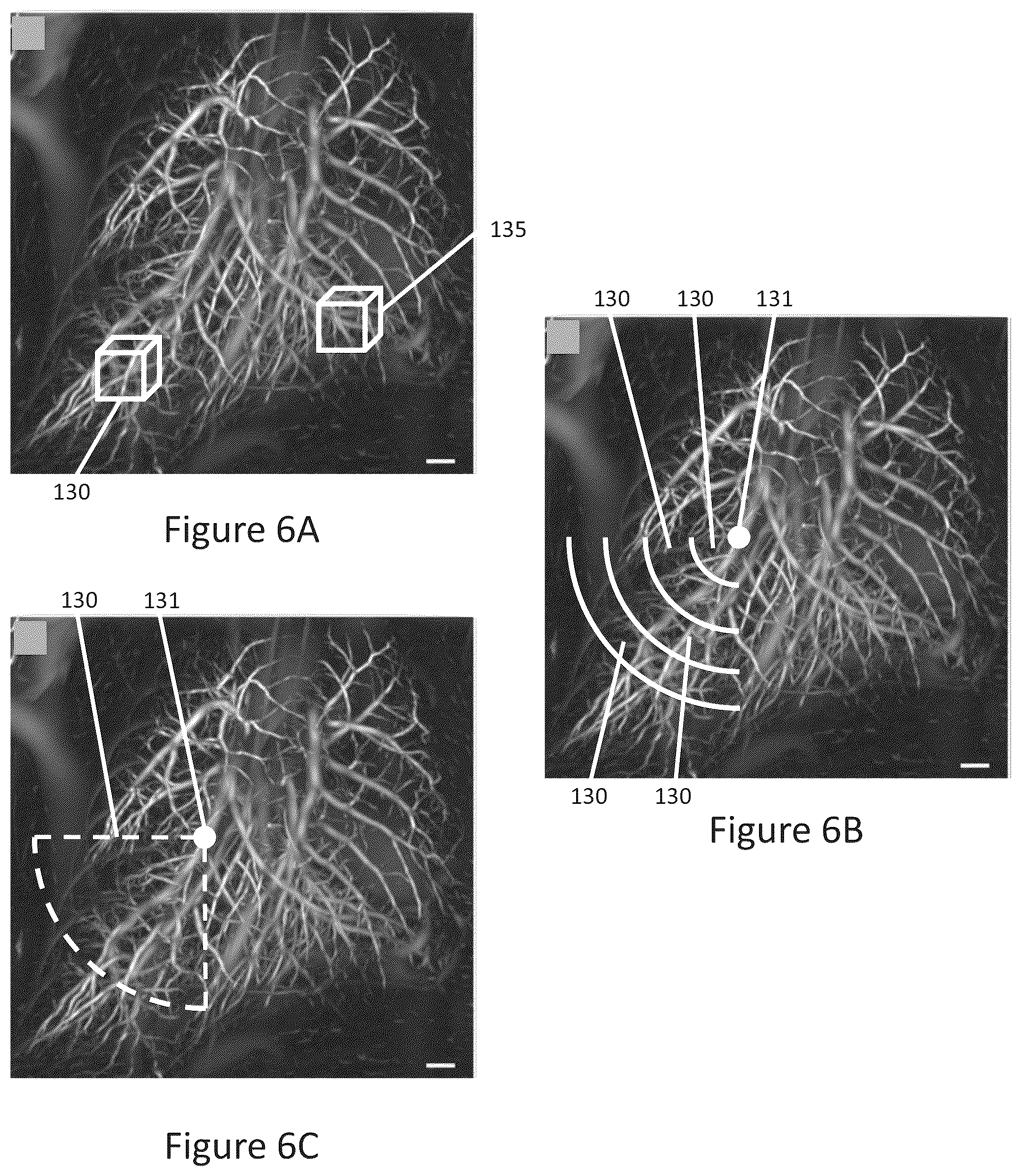 Patent US12102414 Figure 4 – Method of scanning and assessing lung and vascular health