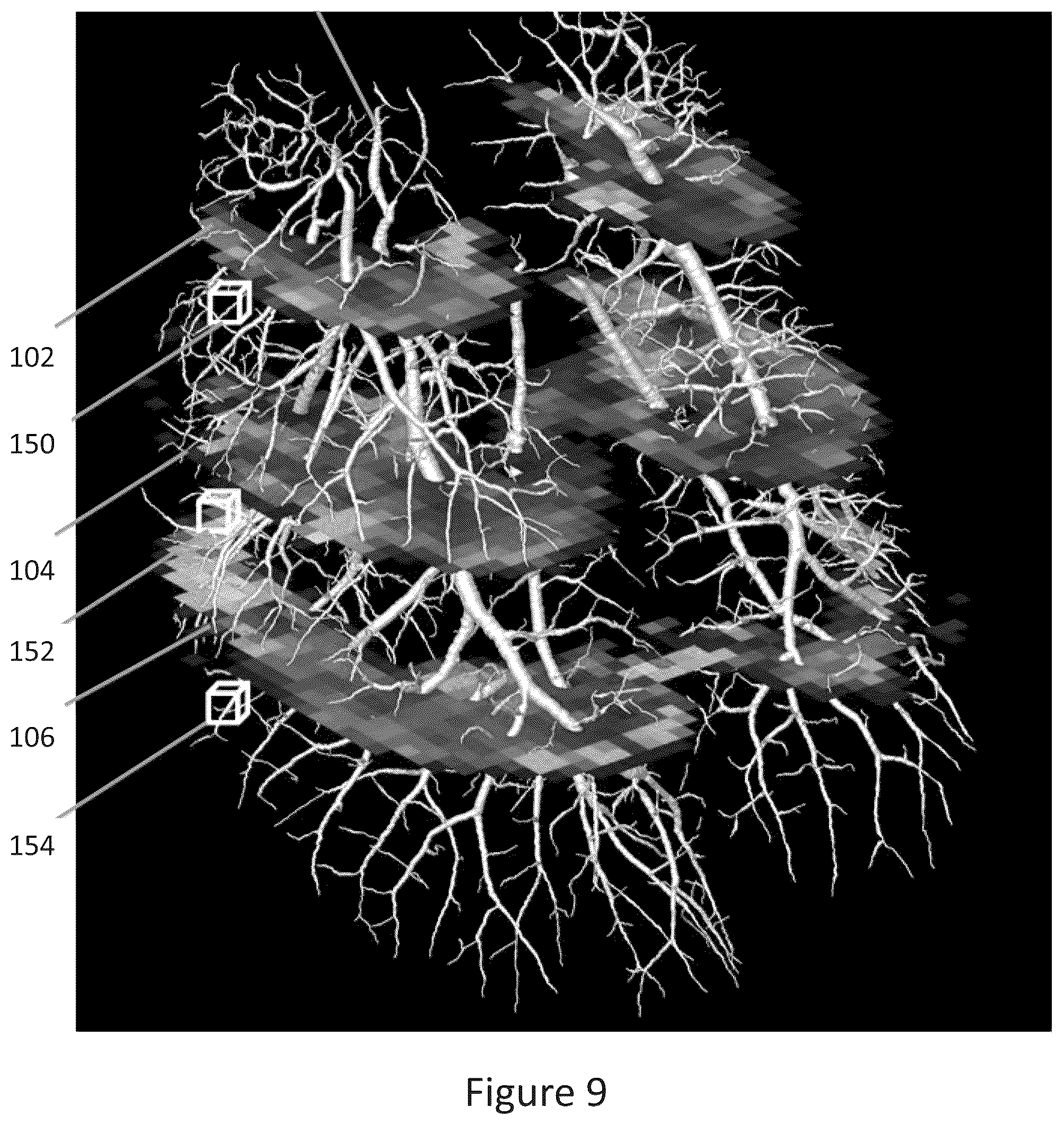 Patent US12102414 Figure 7 – Method of scanning and assessing lung and vascular health