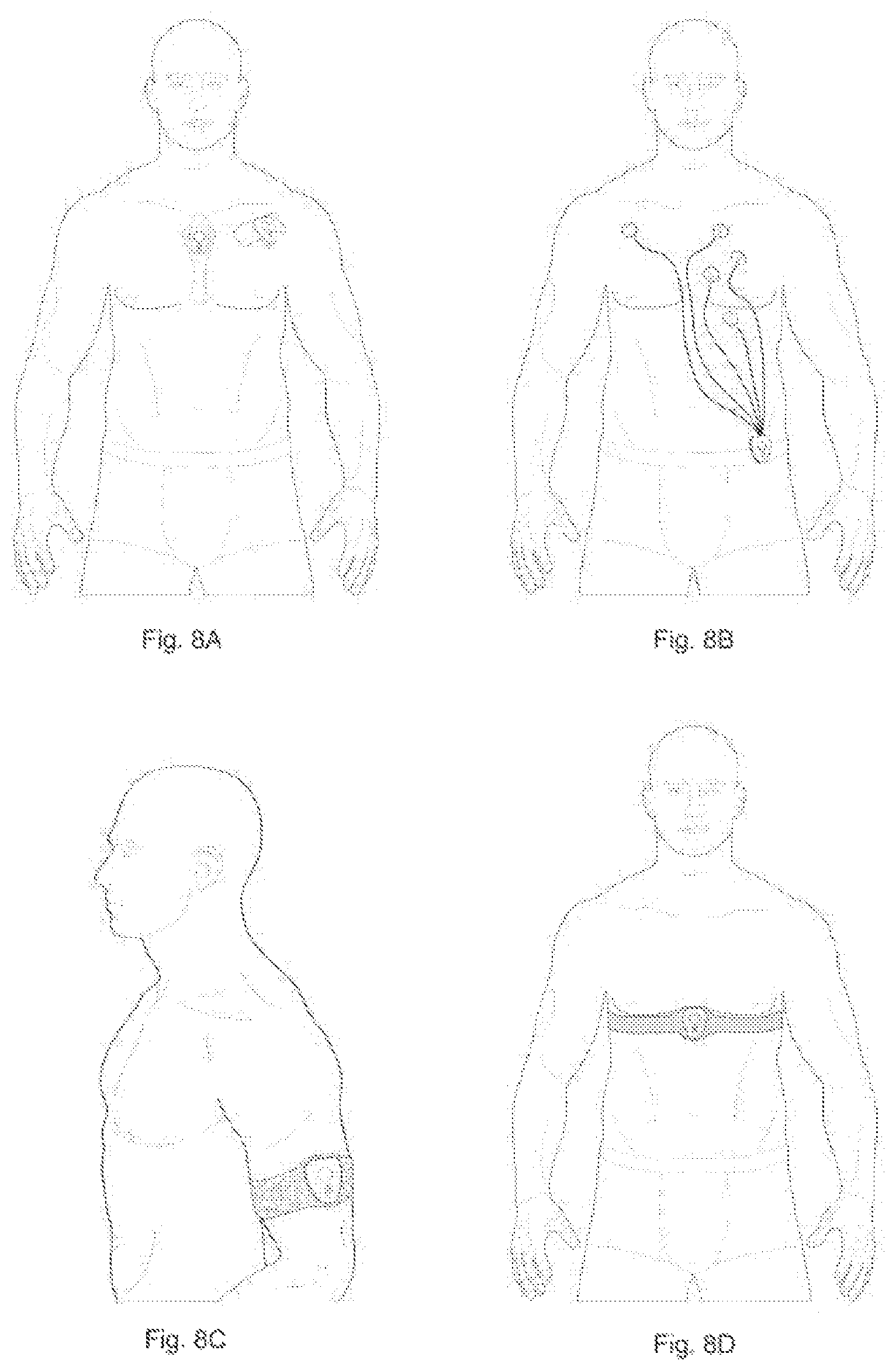 Patent US12102418 Figure 10 – Medical device for monitoring health parameters of a patient and method of monitoring health parameters of a patient