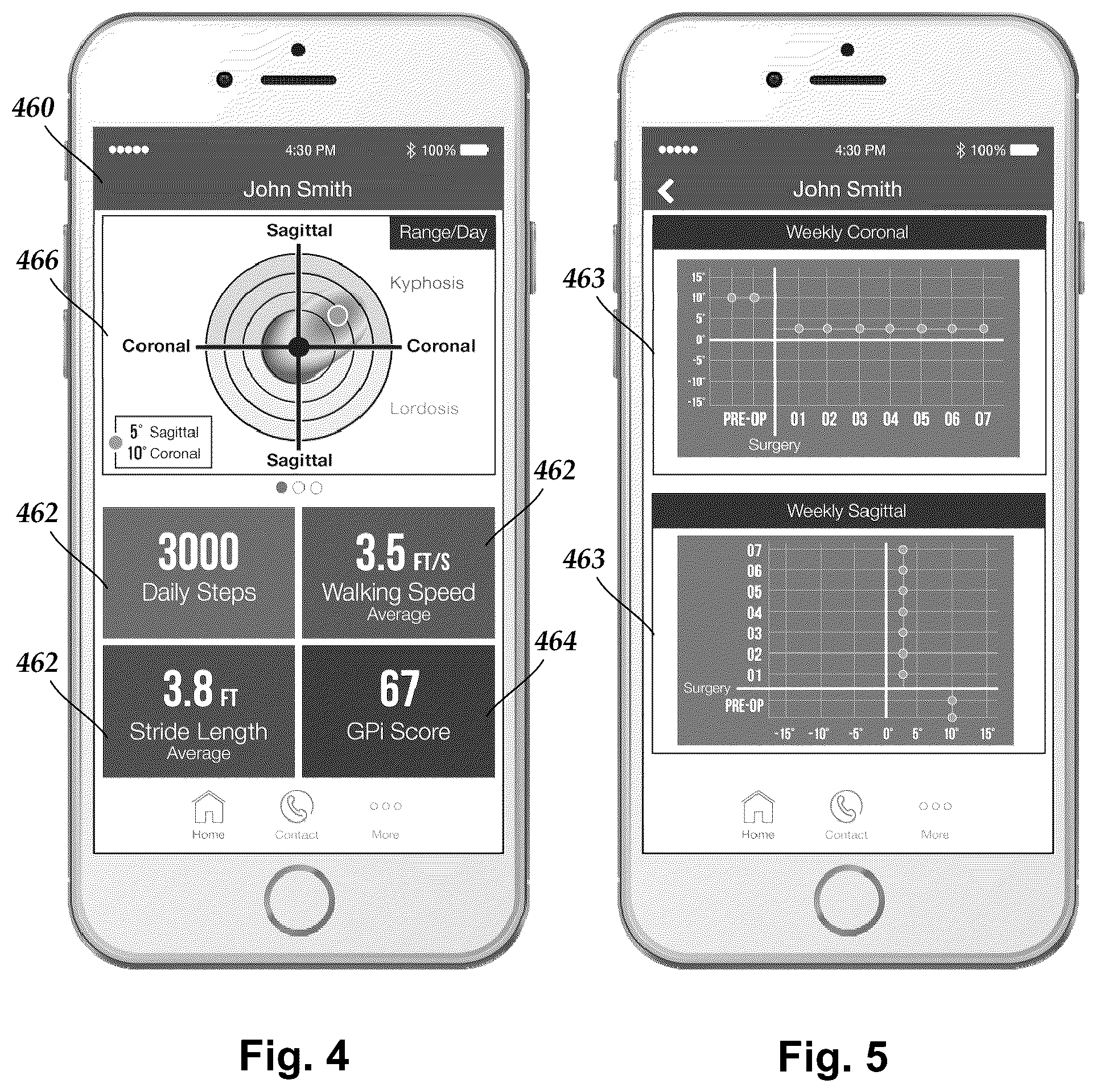 Patent US12102425 Figure 3 – System and methods for monitoring the spine, balance, gait, or posture of a patient