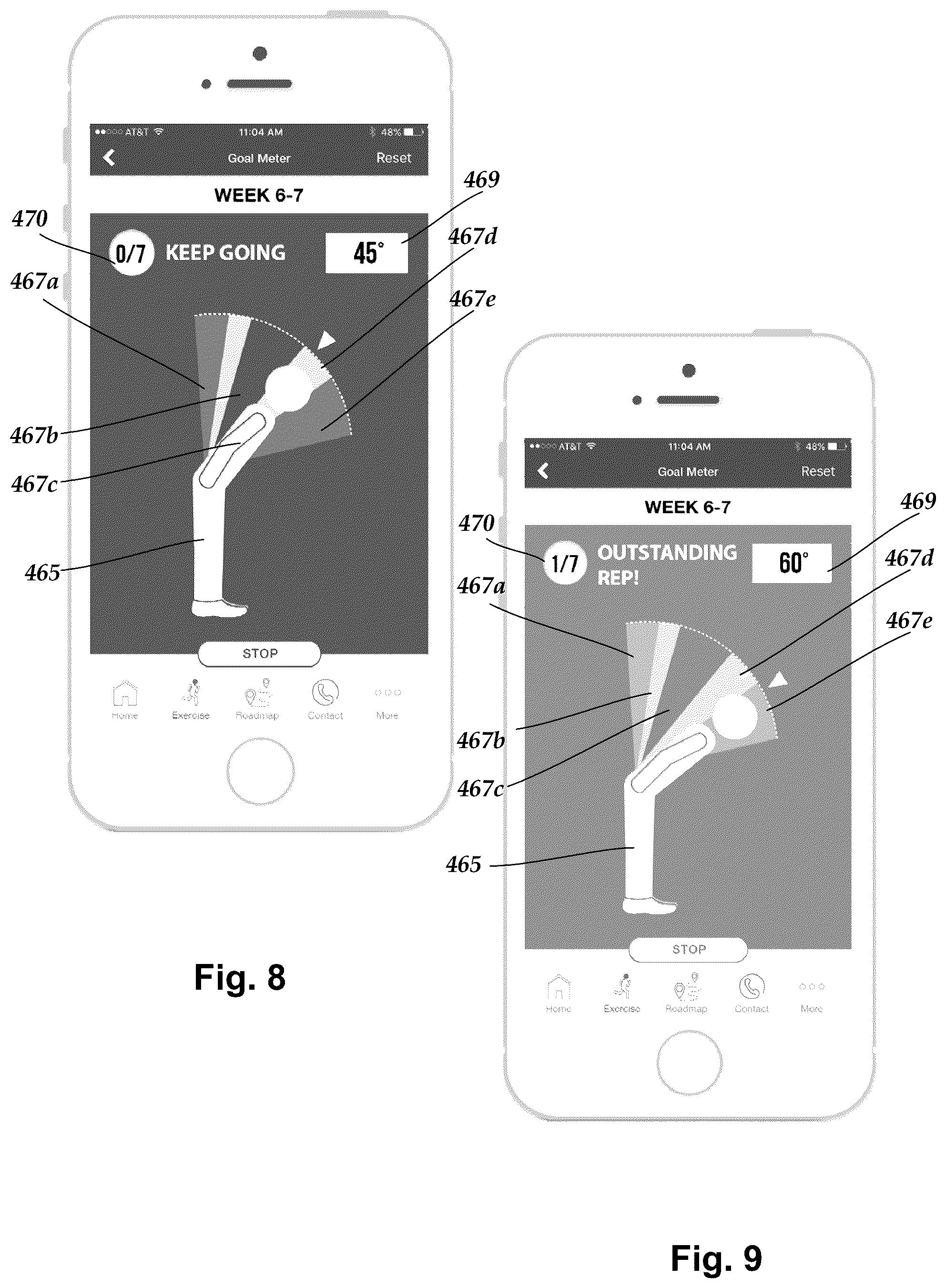 Patent US12102425 Figure 5 – System and methods for monitoring the spine, balance, gait, or posture of a patient