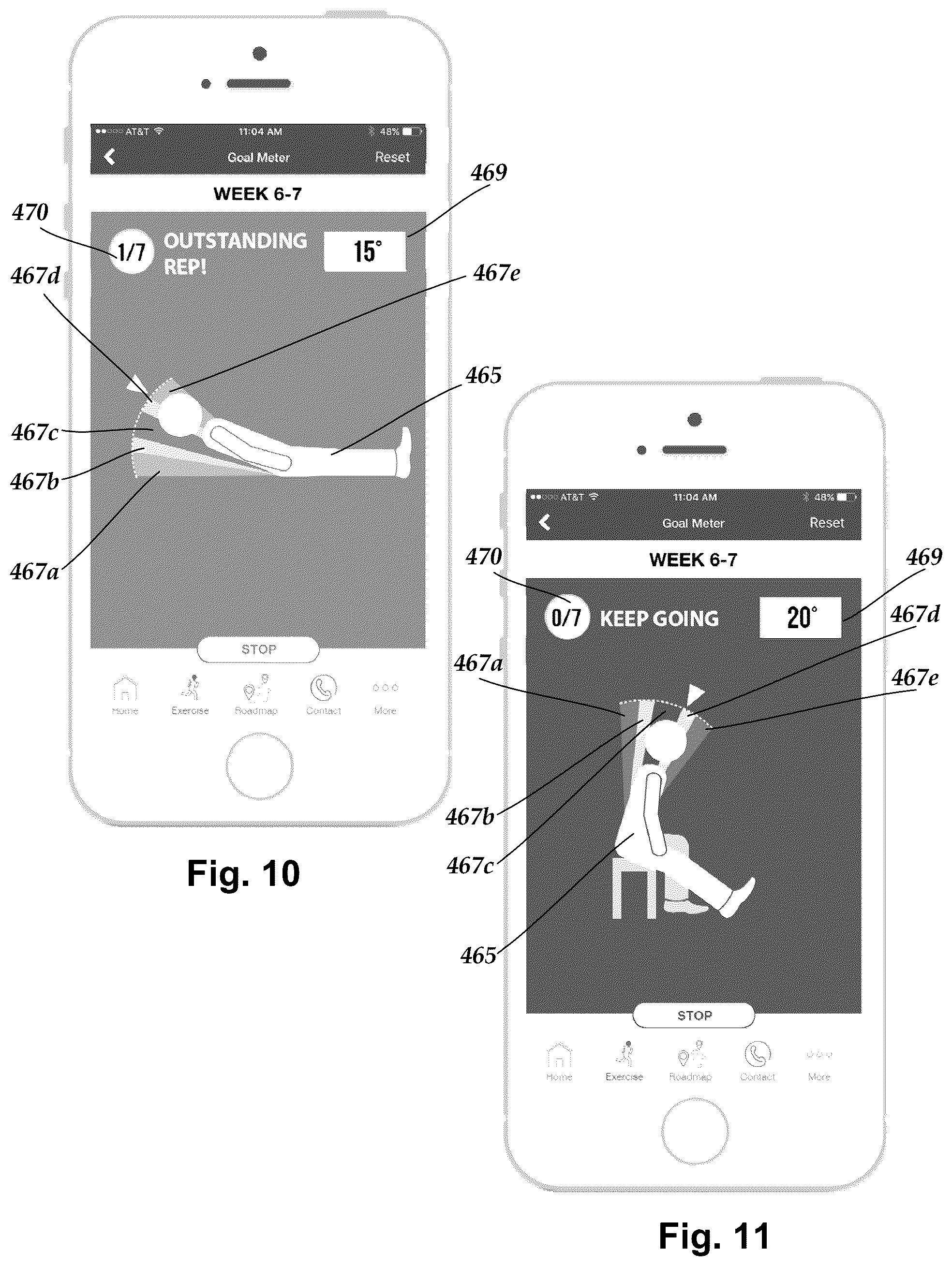 Patent US12102425 Figure 6 – System and methods for monitoring the spine, balance, gait, or posture of a patient