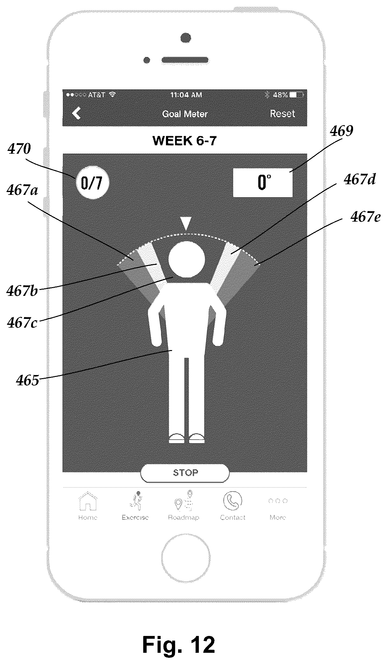 Patent US12102425 Figure 7 – System and methods for monitoring the spine, balance, gait, or posture of a patient