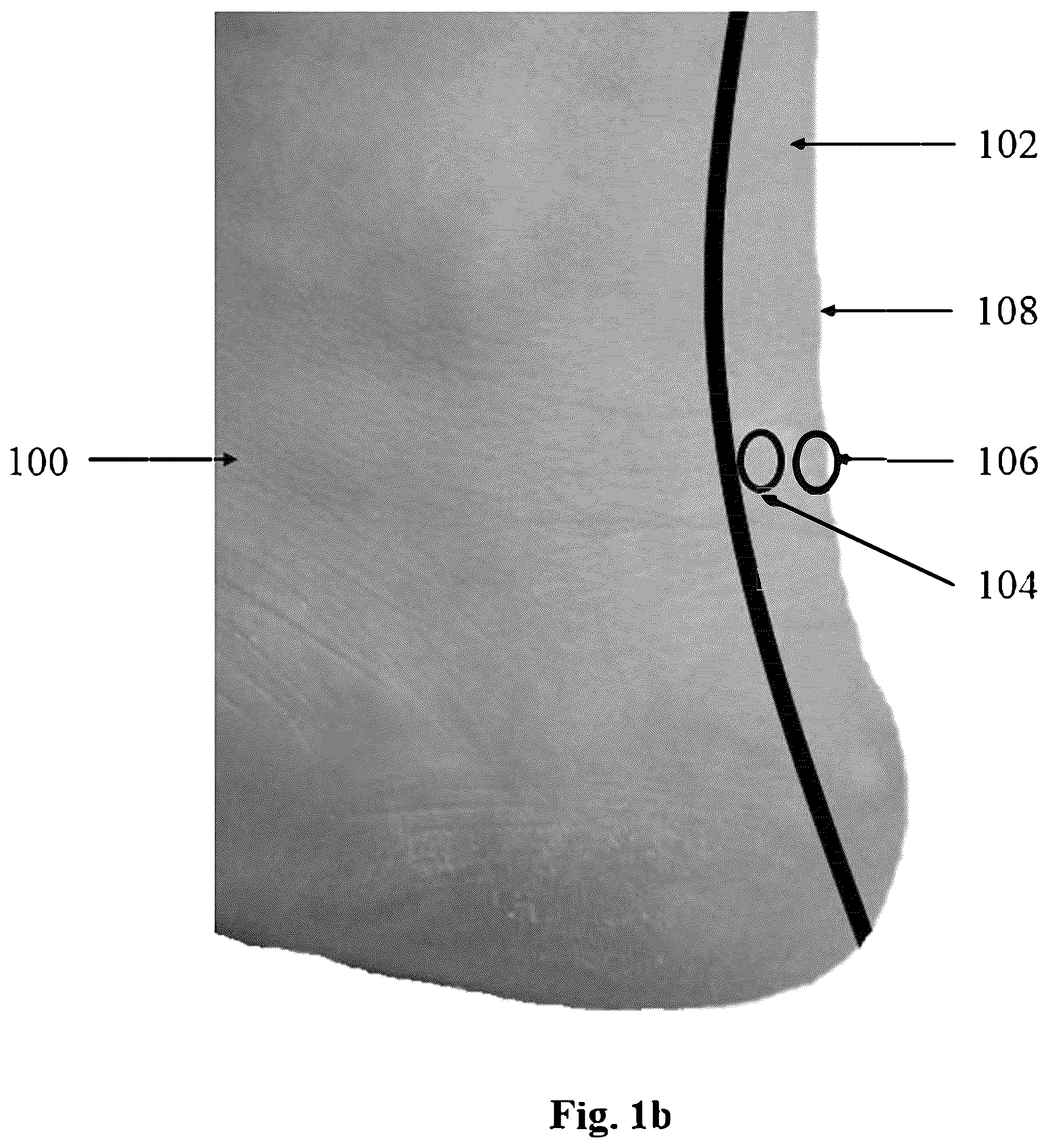 Patent US12102435 Figure 2 – Systems, devices, and methods for non-invasive and non-destructive imaging and measurement of tissue and material mechanical properties