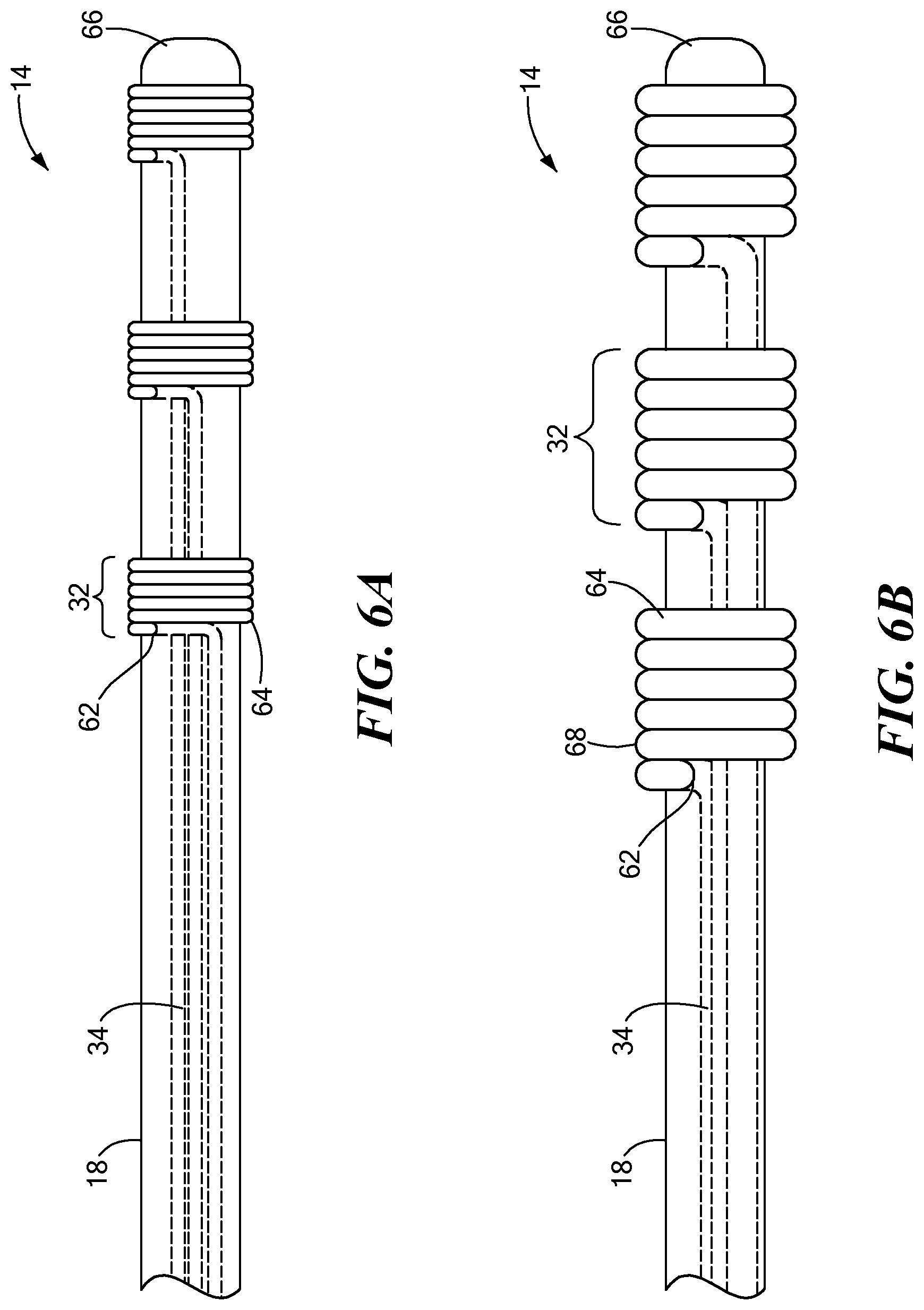 Patent US12102436 Figure 4 – Electrophysiology catheter design