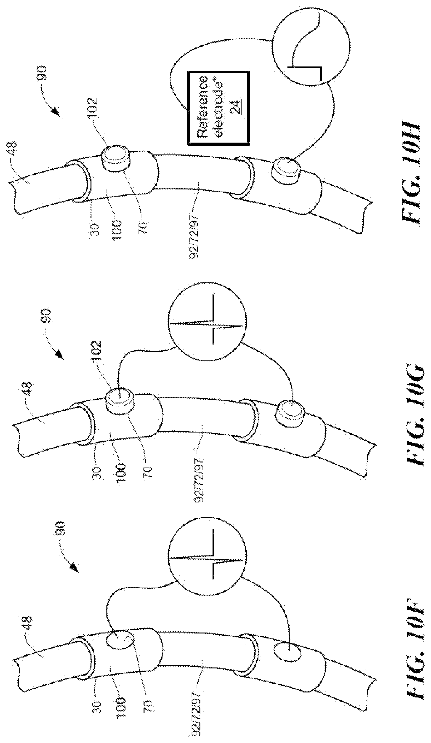 Patent US12102436 Figure 9 – Electrophysiology catheter design