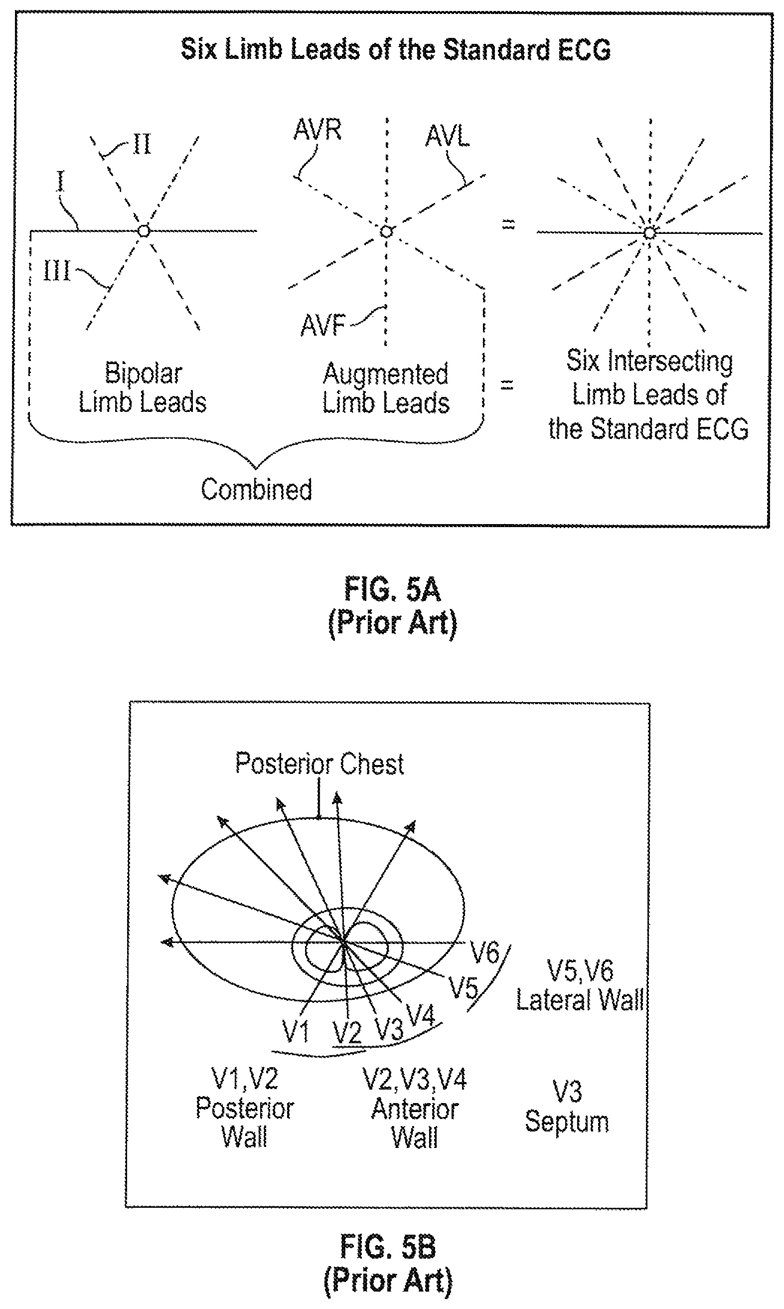 Patent US12102438 Figure 6 – Pendant physiological signal monitor and associated systems and methods