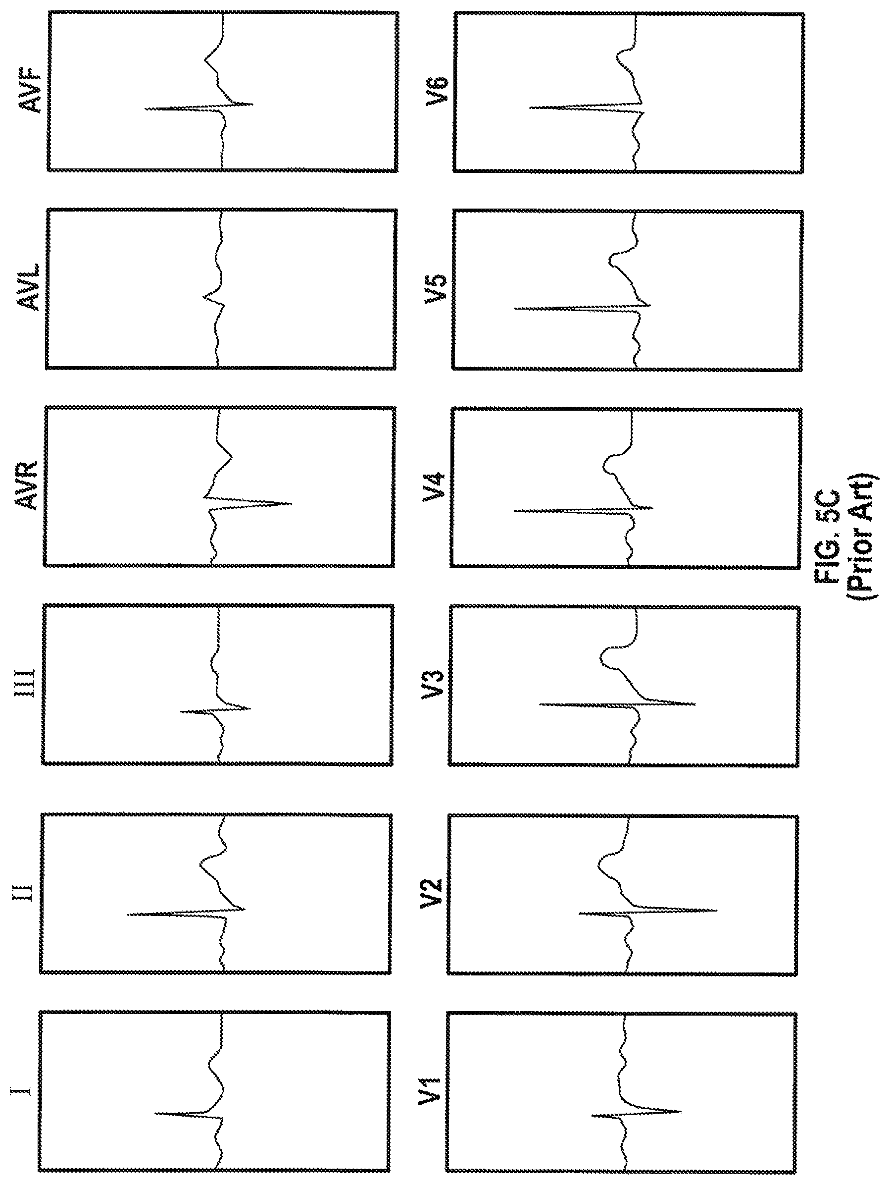 Patent US12102438 Figure 7 – Pendant physiological signal monitor and associated systems and methods