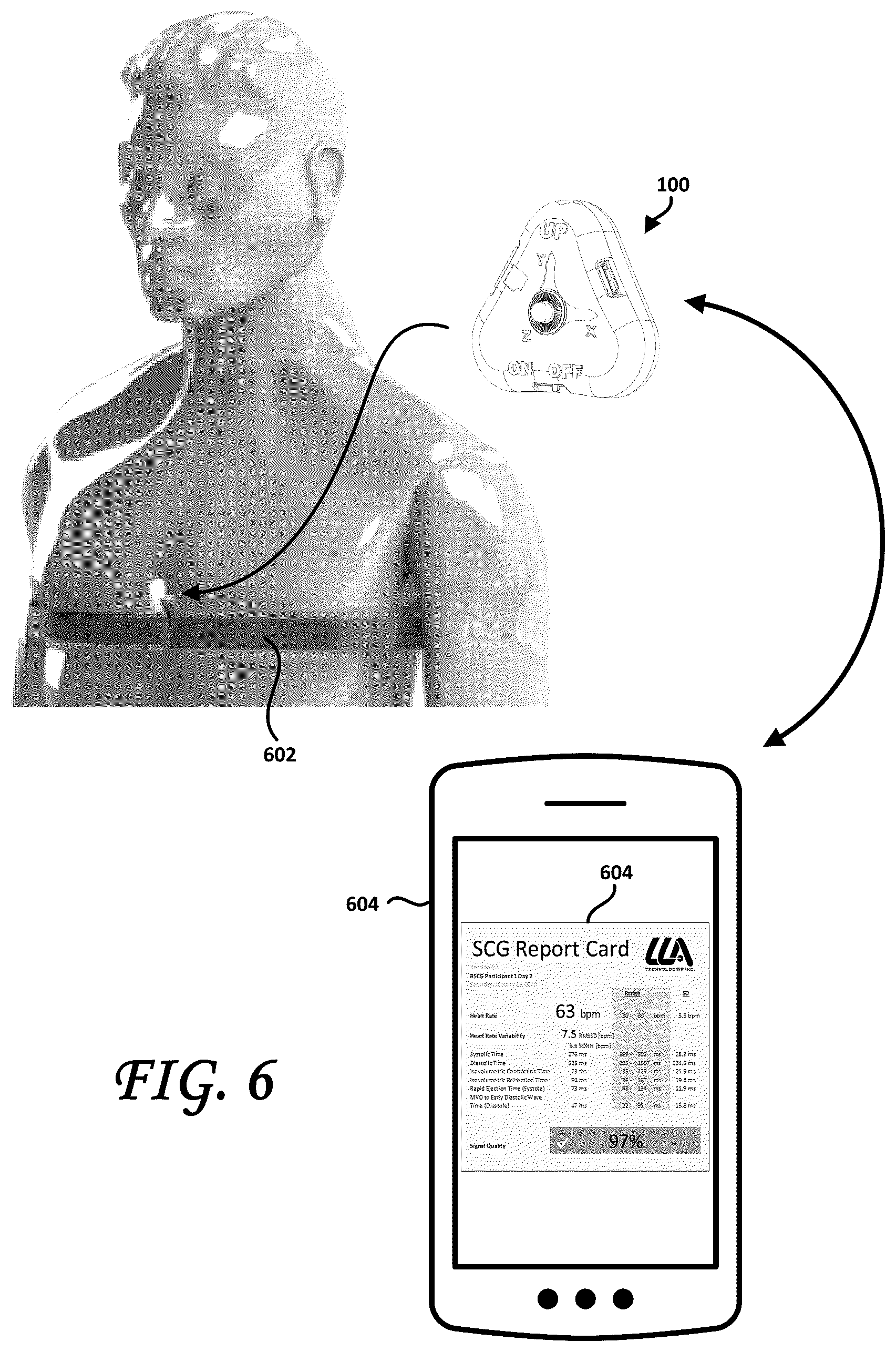 Patent US12102439 Figure 5 – Tri-axial seismocardiography methods