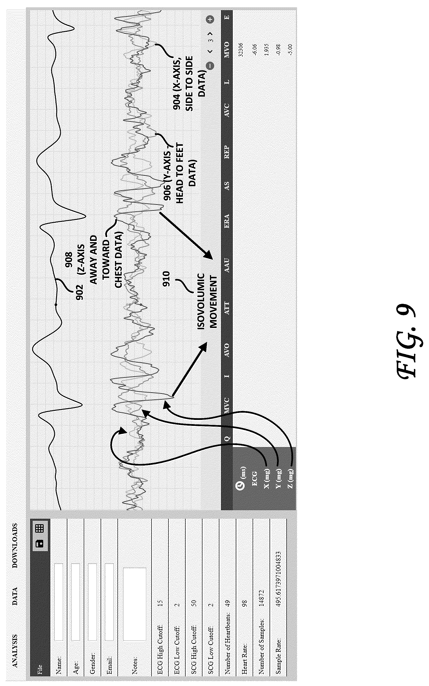 Patent US12102439 Figure 8 – Tri-axial seismocardiography methods
