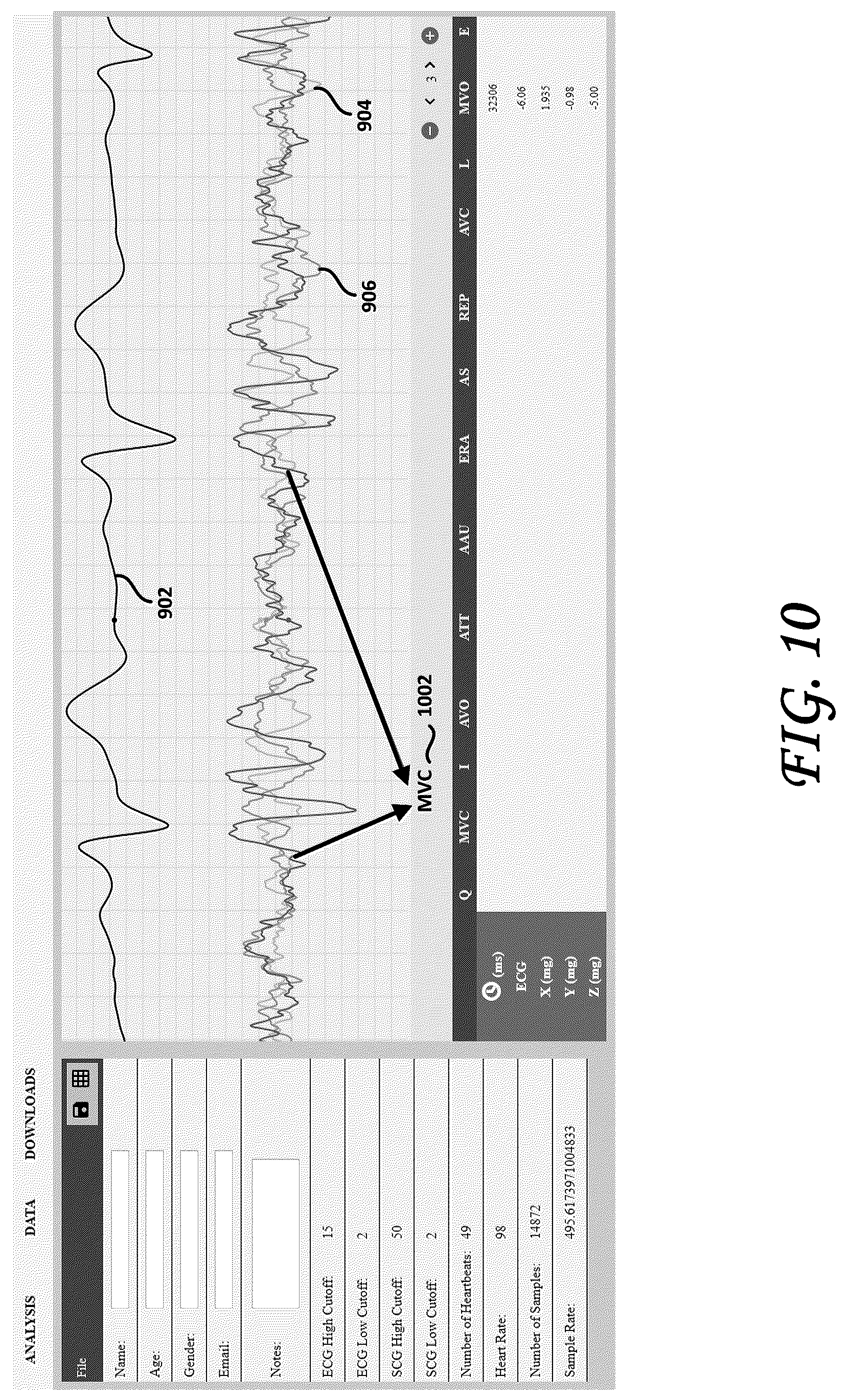 Patent US12102439 Figure 9 – Tri-axial seismocardiography methods