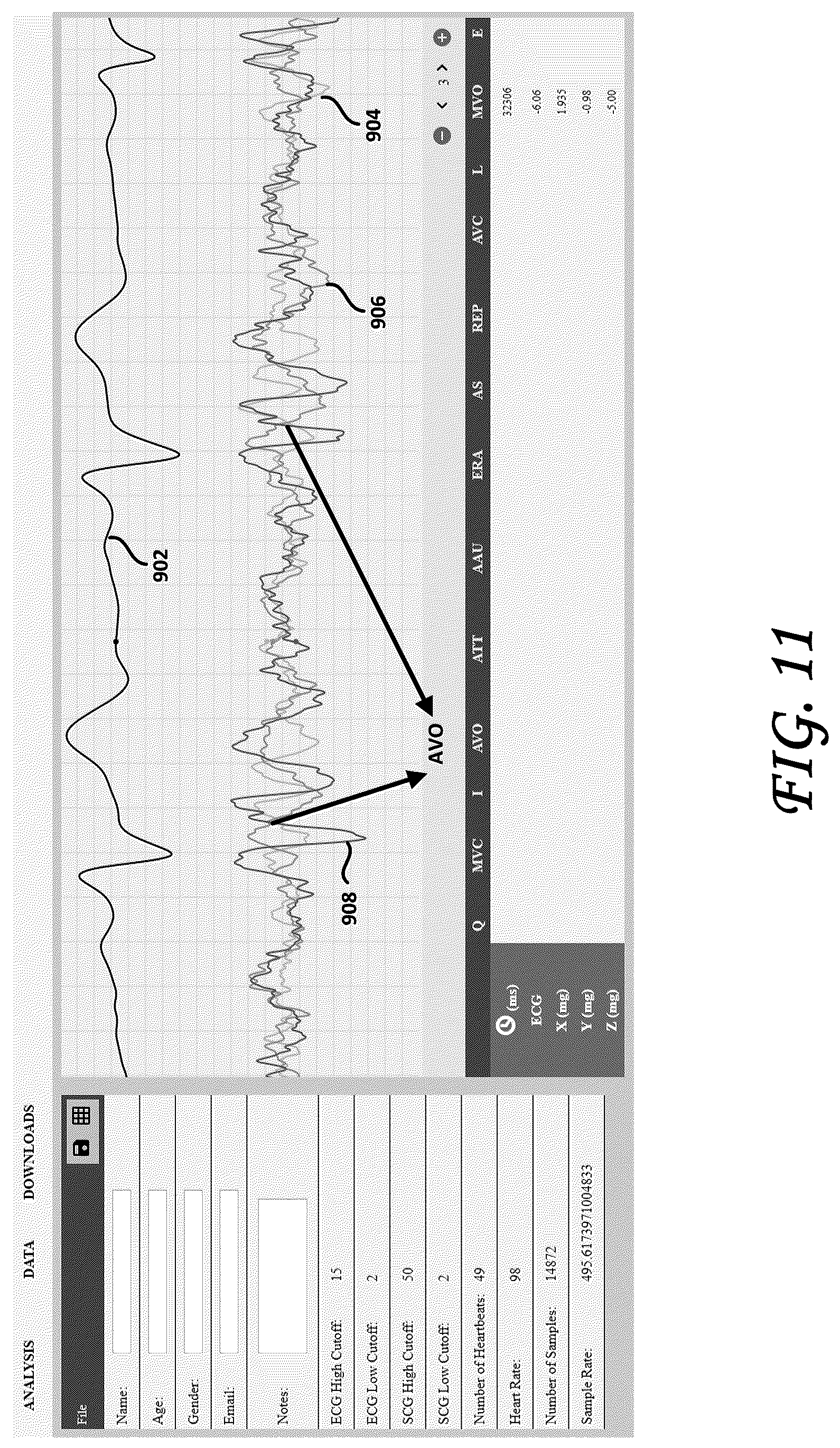 Patent US12102439 Figure 10 – Tri-axial seismocardiography methods