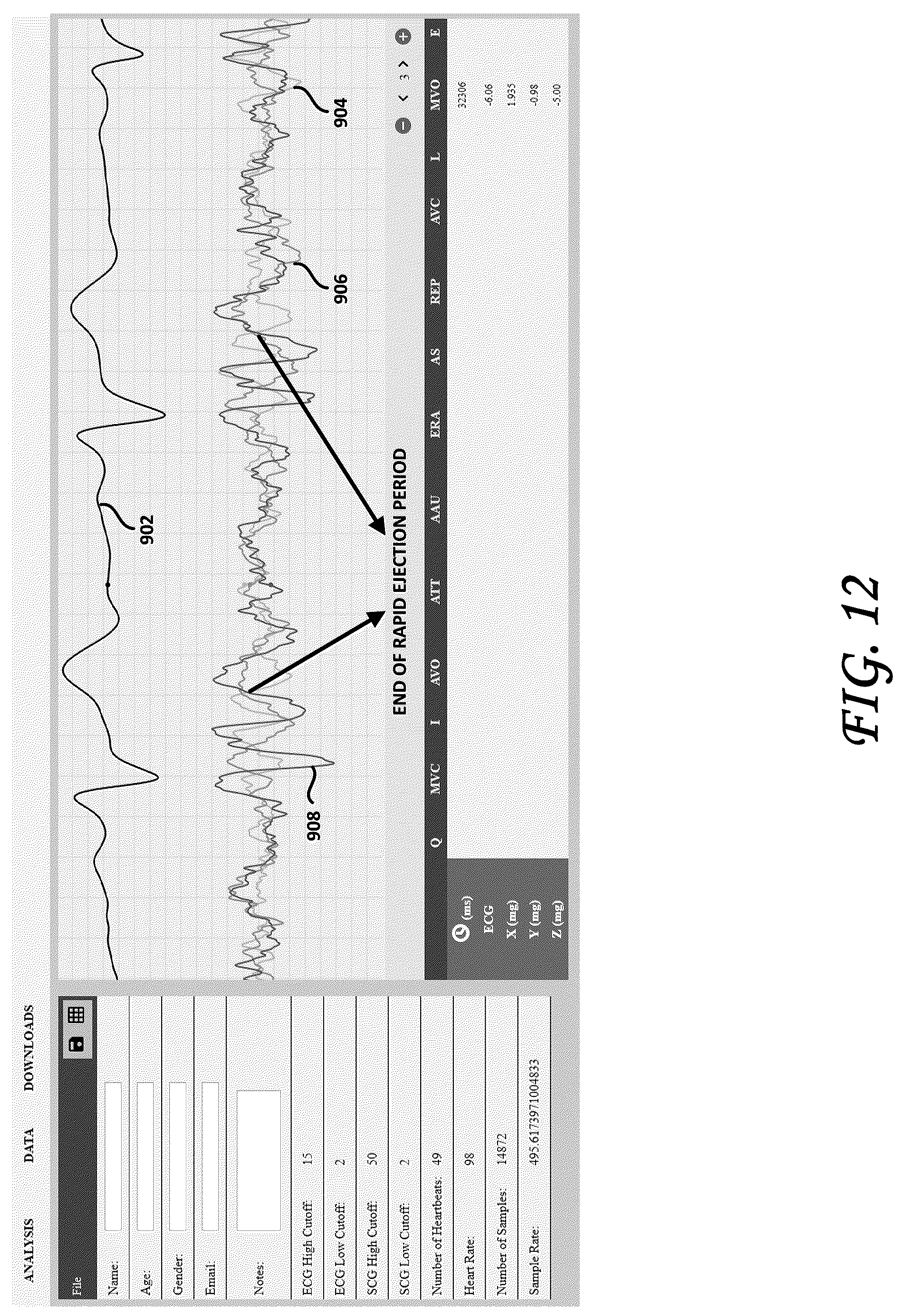 Patent US12102439 Figure 11 – Tri-axial seismocardiography methods