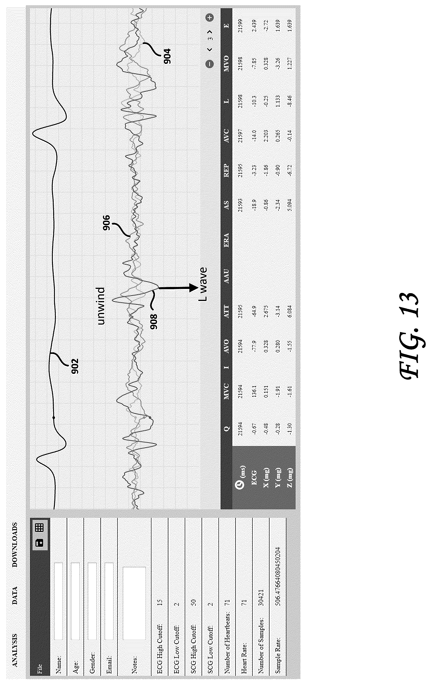 Patent US12102439 Figure 12 – Tri-axial seismocardiography methods