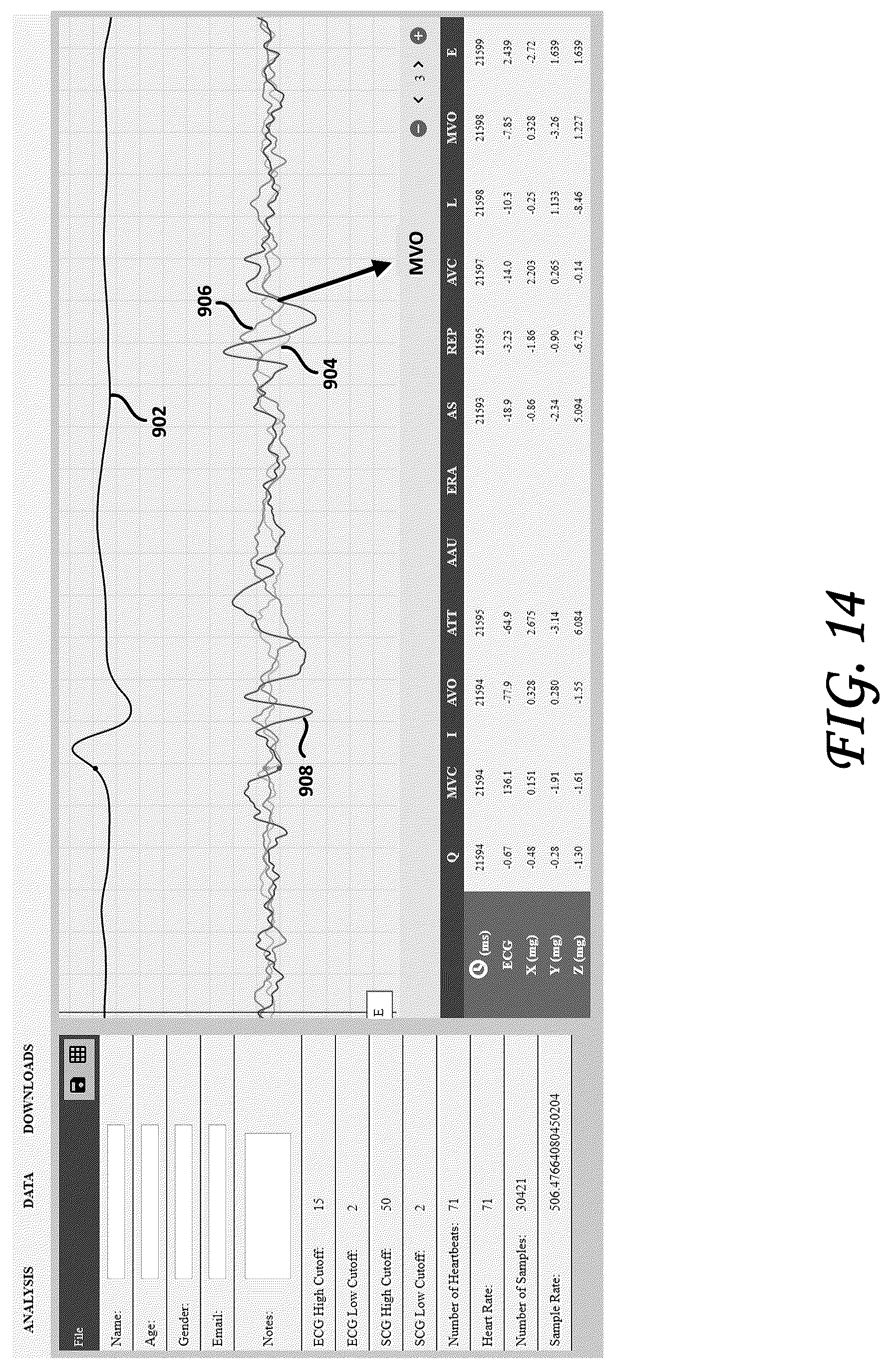 Patent US12102439 Figure 13 – Tri-axial seismocardiography methods
