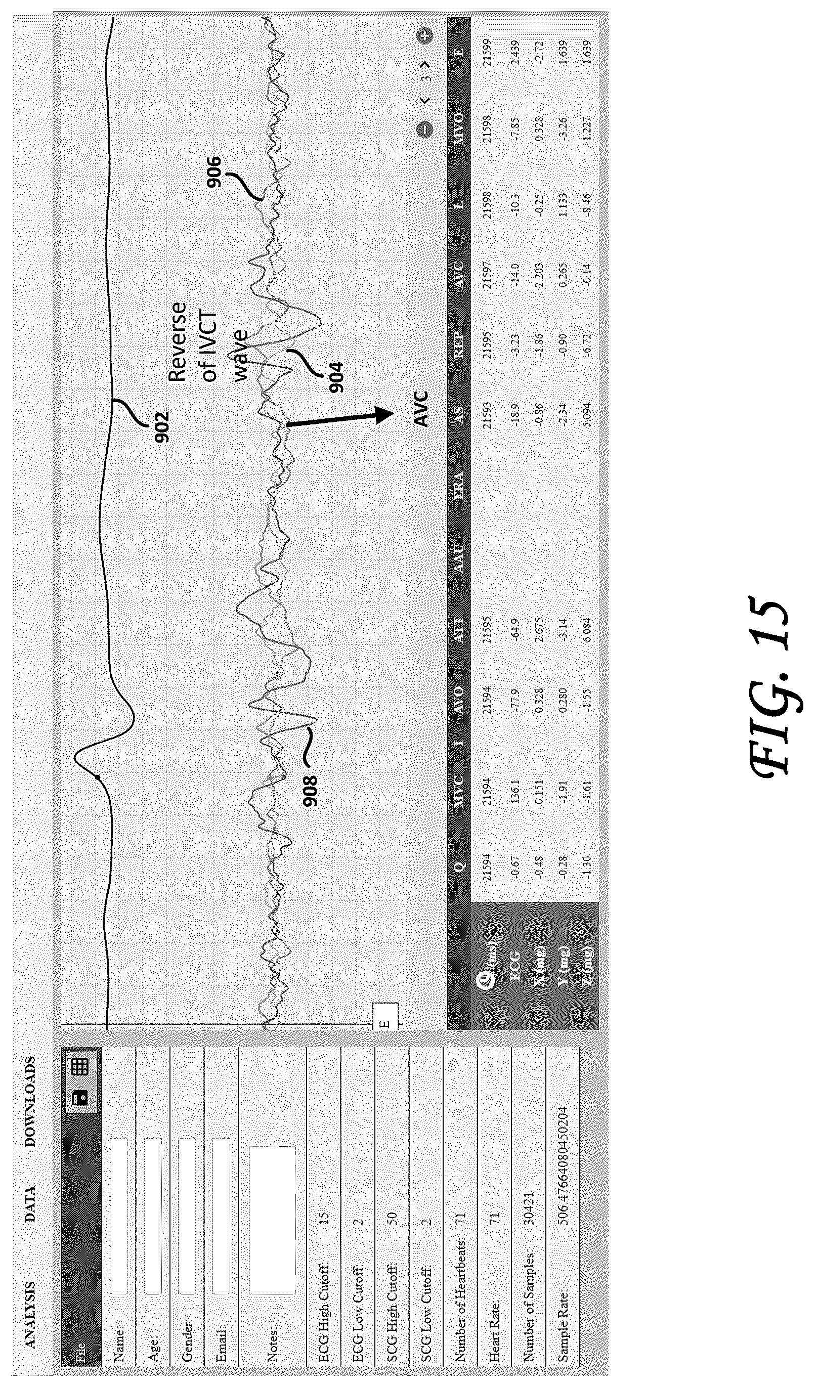 Patent US12102439 Figure 14 – Tri-axial seismocardiography methods