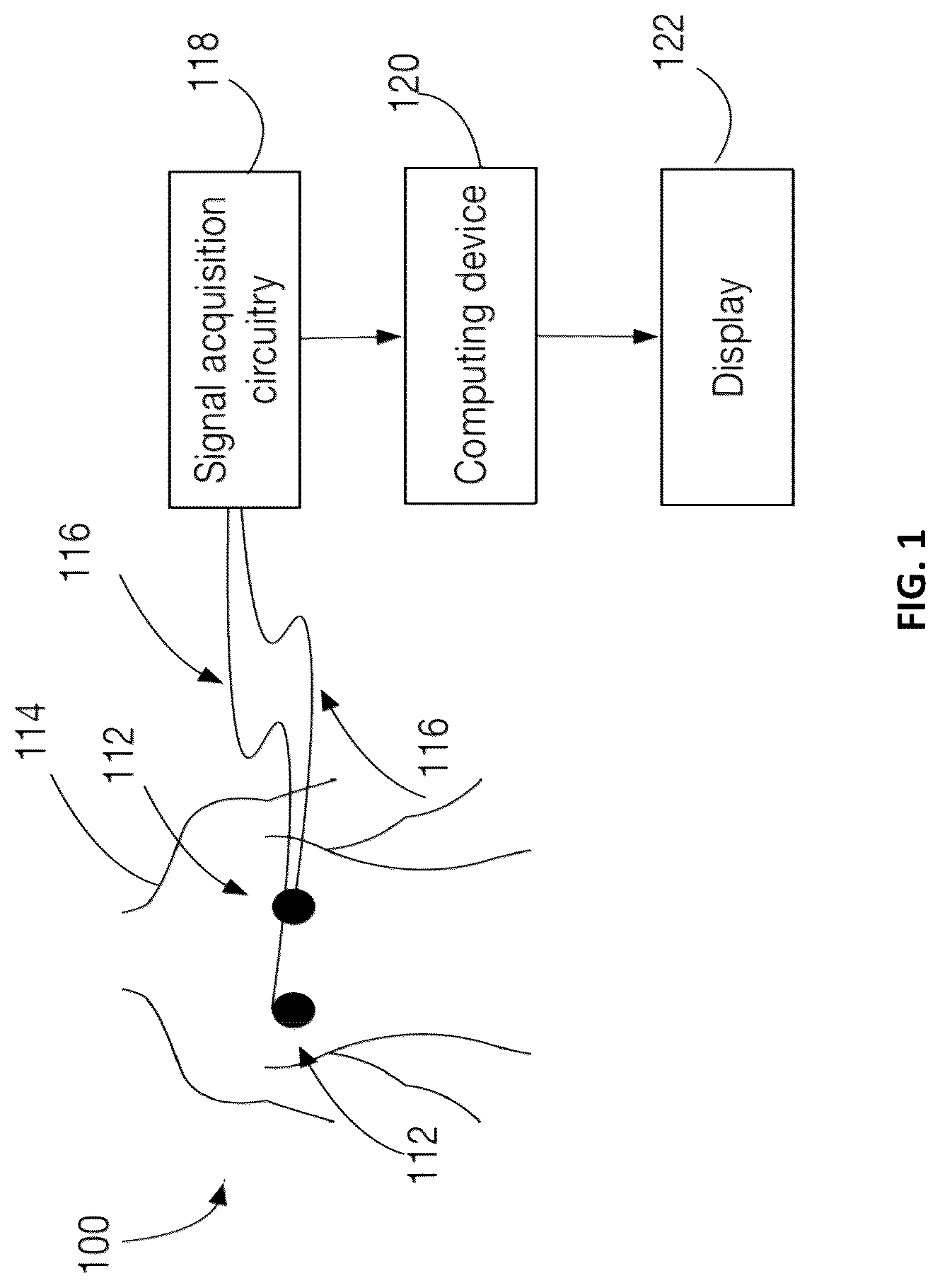 Patent US12102440 Figure 1 – Method and system for measuring cardiac electrogram depolarization voltage