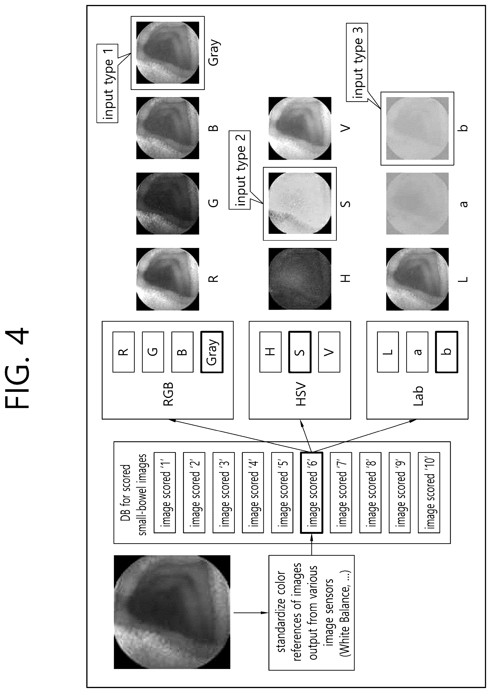 Patent US12102441 Figure 4 – System and method for diagnosing small bowel cleanliness