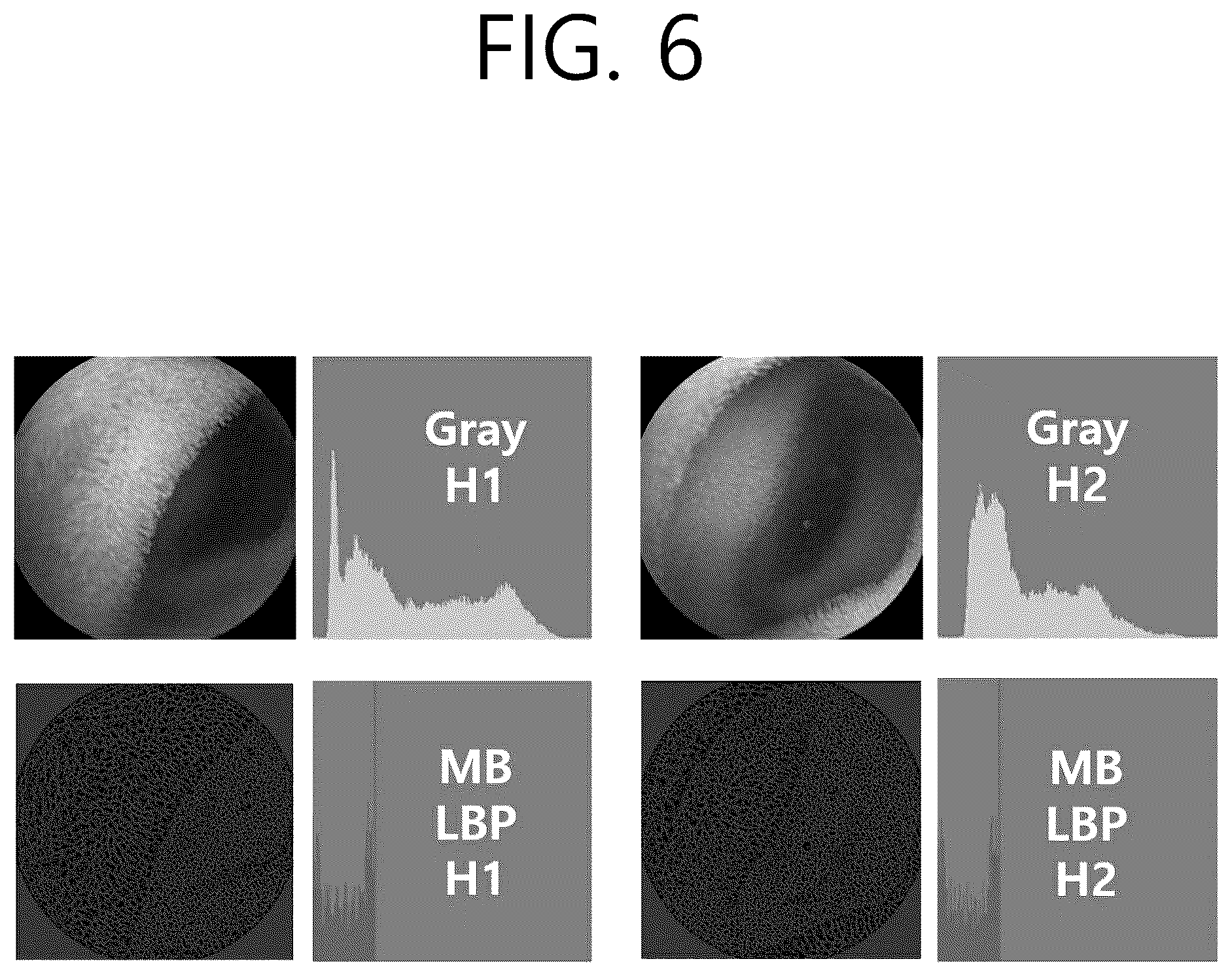 Patent US12102441 Figure 6 – System and method for diagnosing small bowel cleanliness