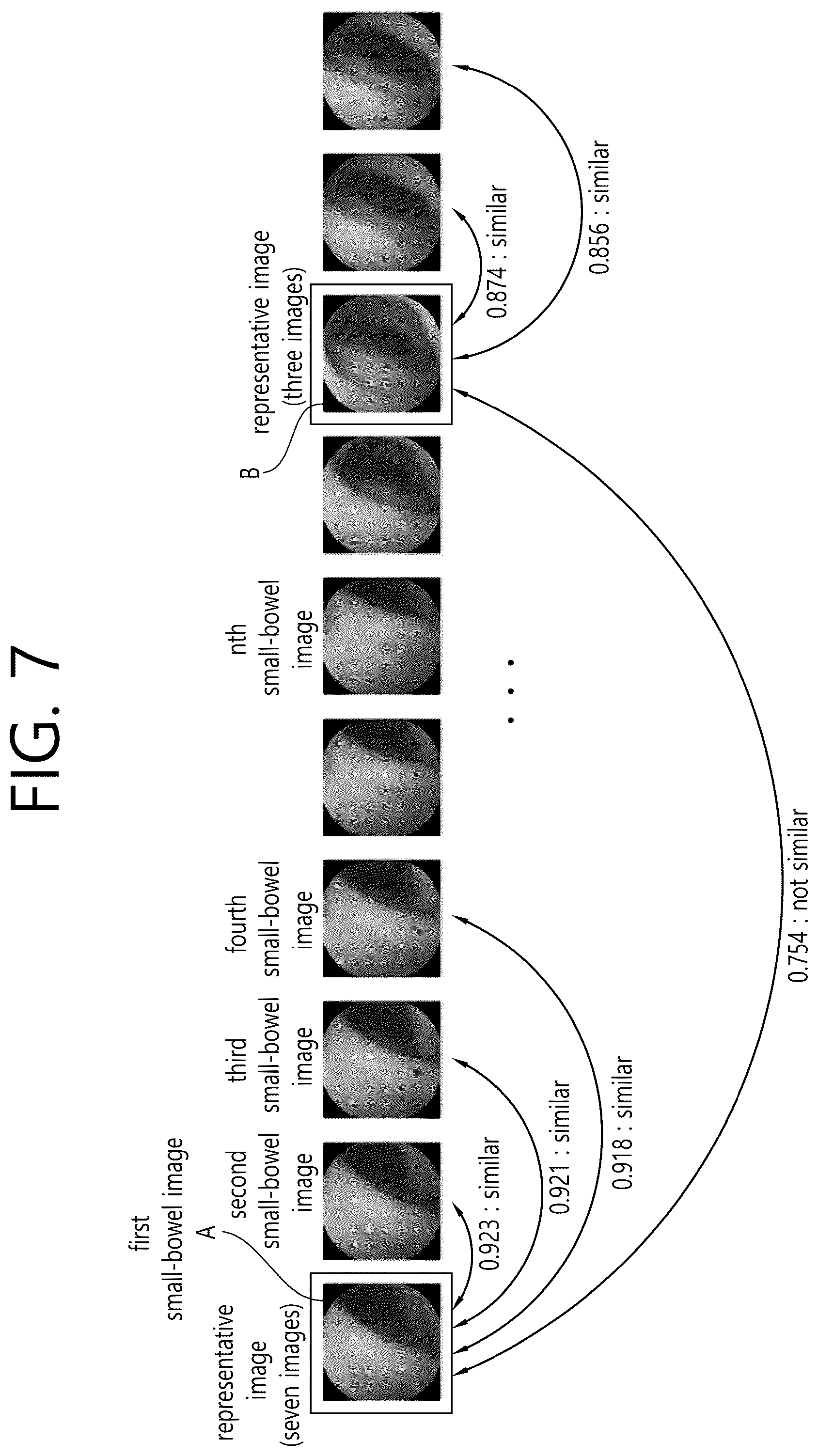 Patent US12102441 Figure 7 – System and method for diagnosing small bowel cleanliness