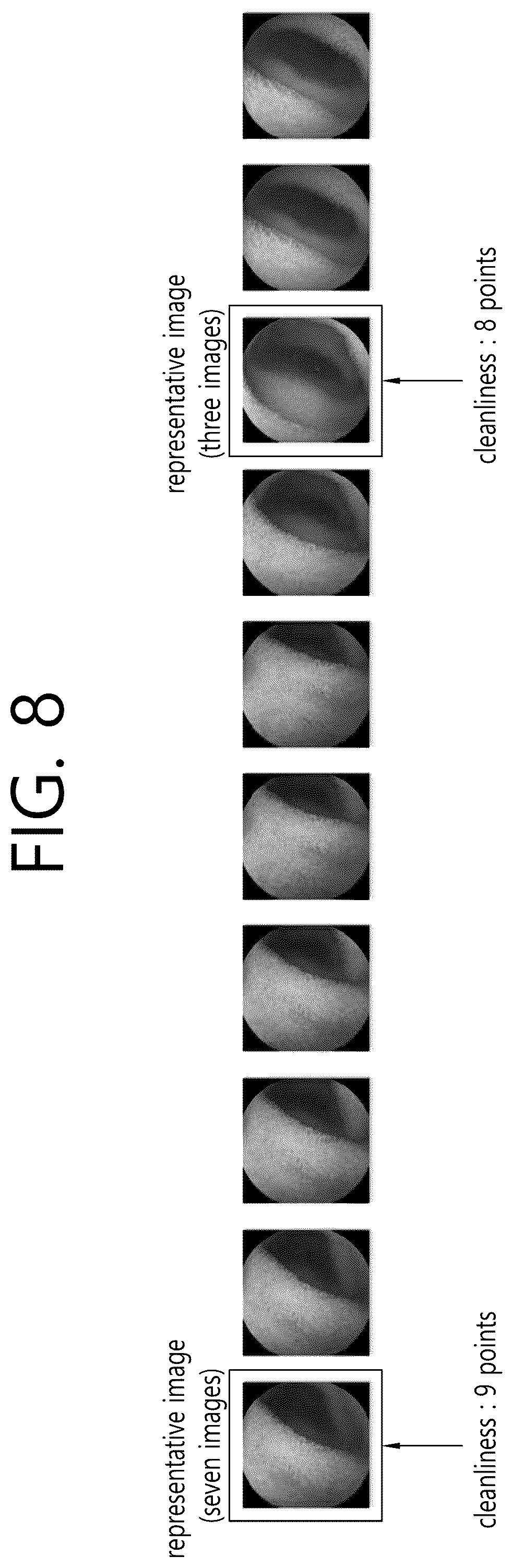Patent US12102441 Figure 8 – System and method for diagnosing small bowel cleanliness