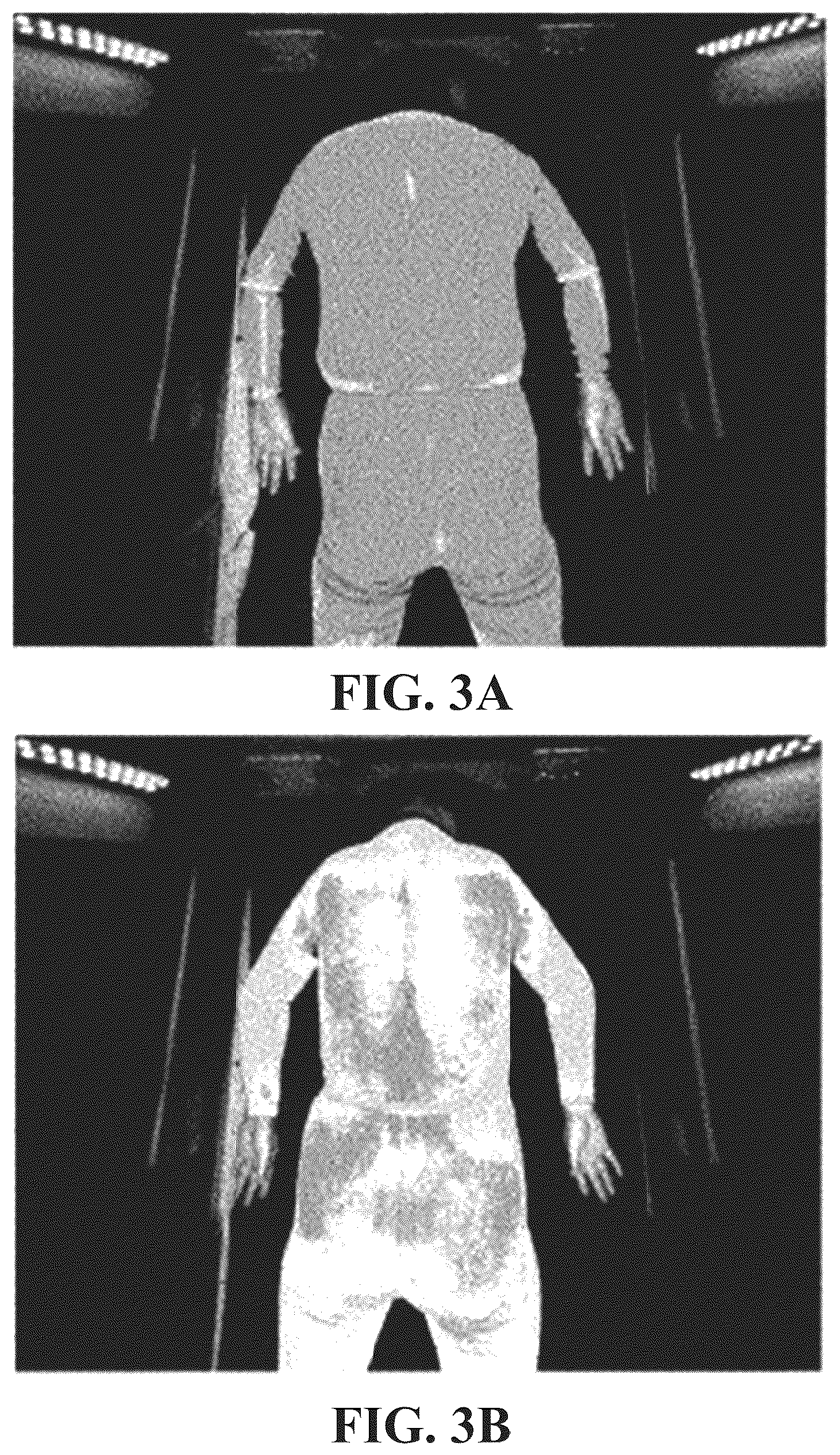 Patent US12102442 Figure 4 – Device for measuring amount of perspiration with regard to each part of human body by using change in brightness and method for measuring amount of perspiration