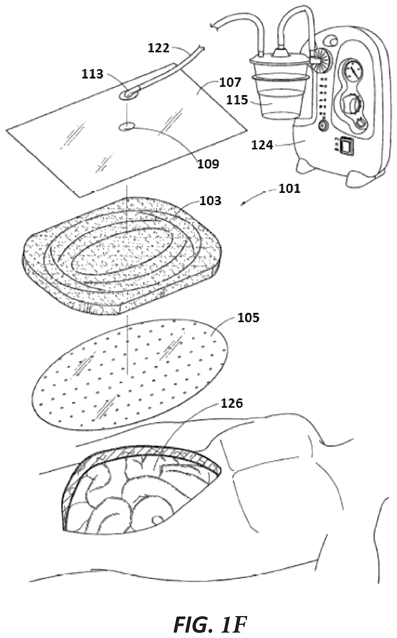 Patent US12102447 Figure 5 – Positioning of sensors for sensor enabled wound monitoring or therapy
