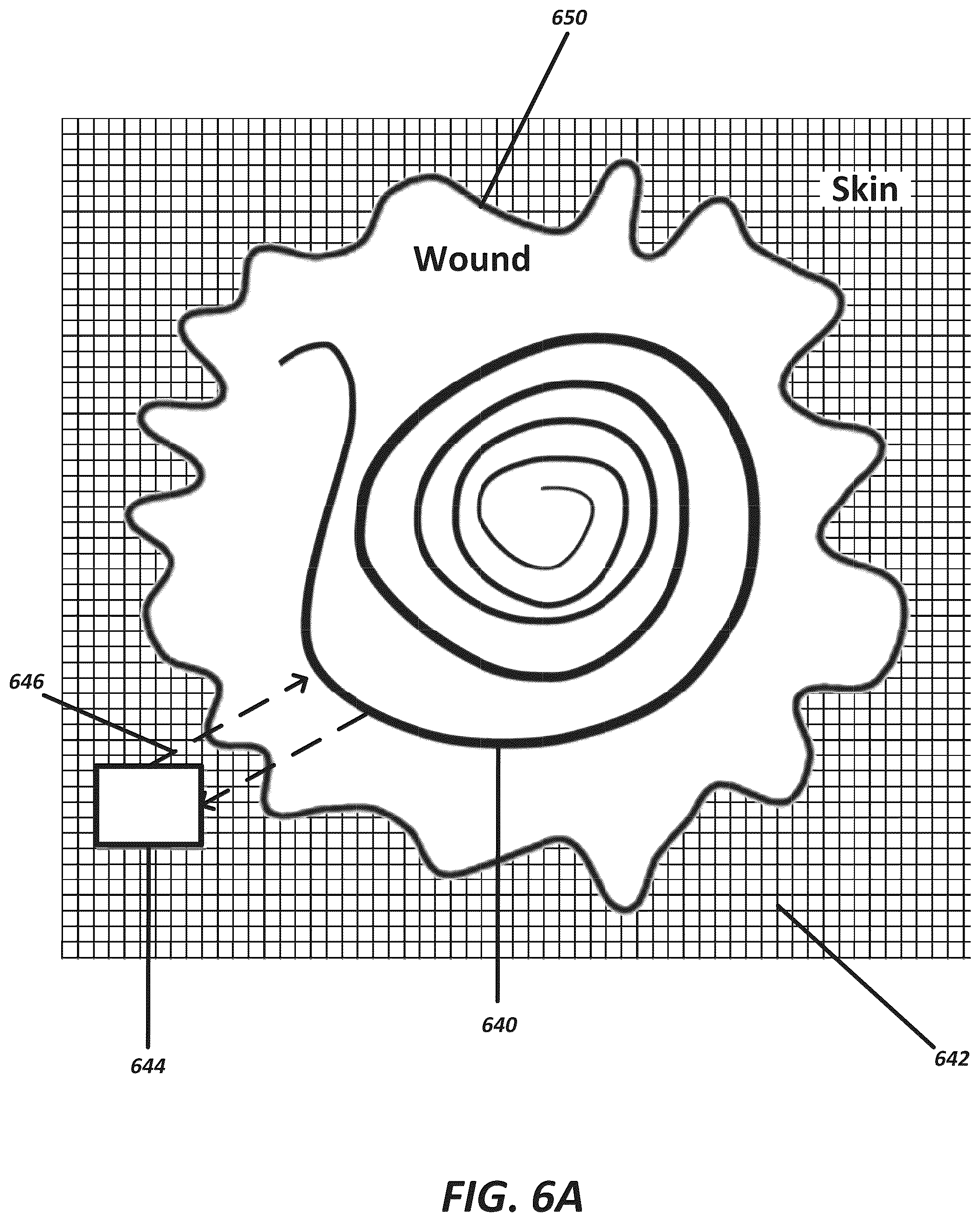 Patent US12102447 Figure 18 – Positioning of sensors for sensor enabled wound monitoring or therapy