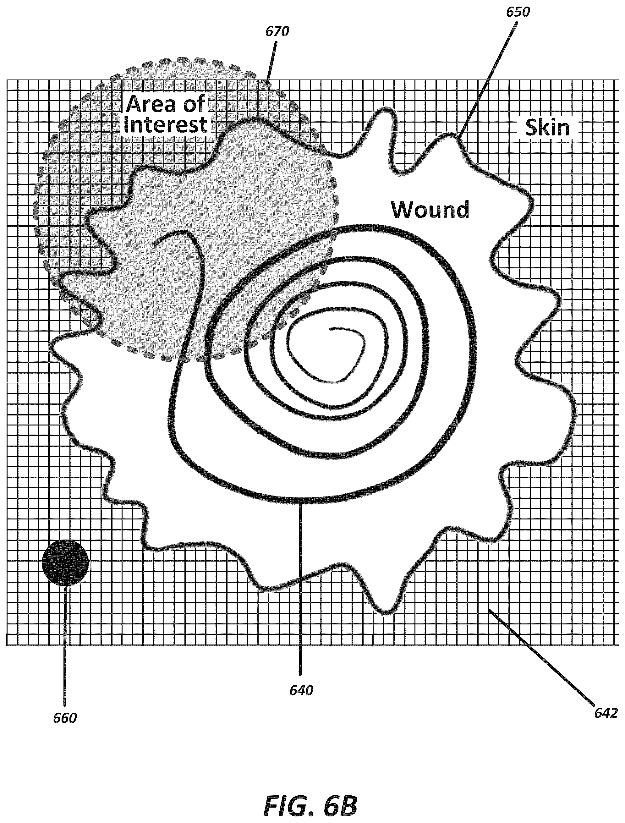 Patent US12102447 Figure 19 – Positioning of sensors for sensor enabled wound monitoring or therapy