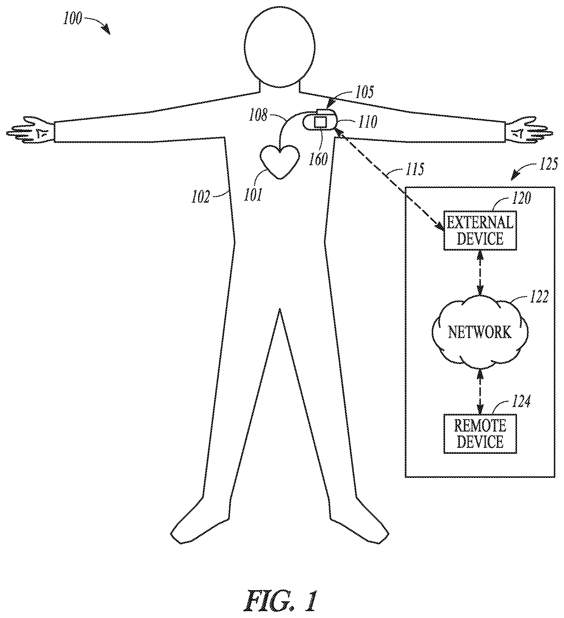 Patent US12102448 Figure 1 – Systems and methods for patient monitoring
