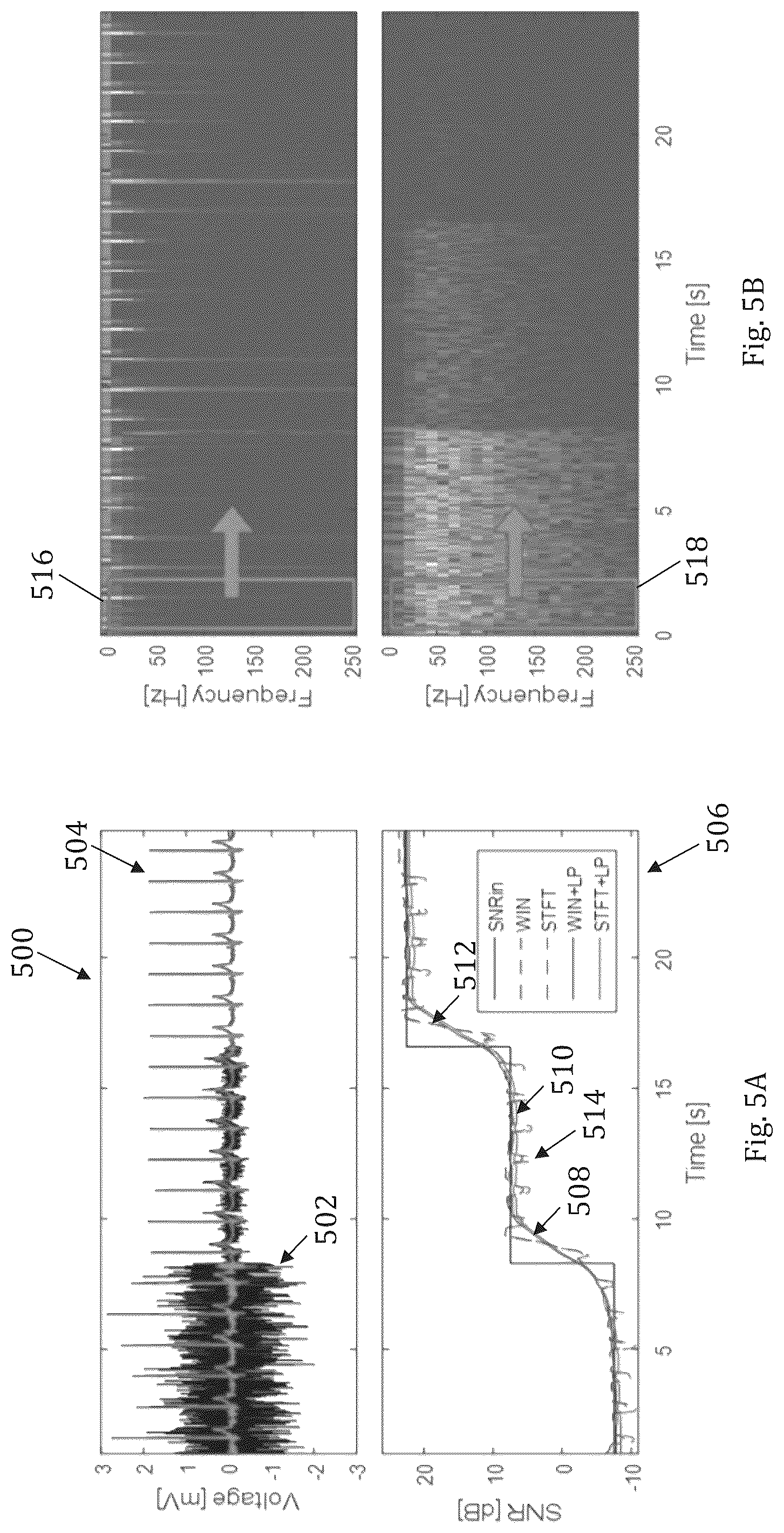 Patent US12102450 Figure 4 – System and method for assessing physiological signal quality