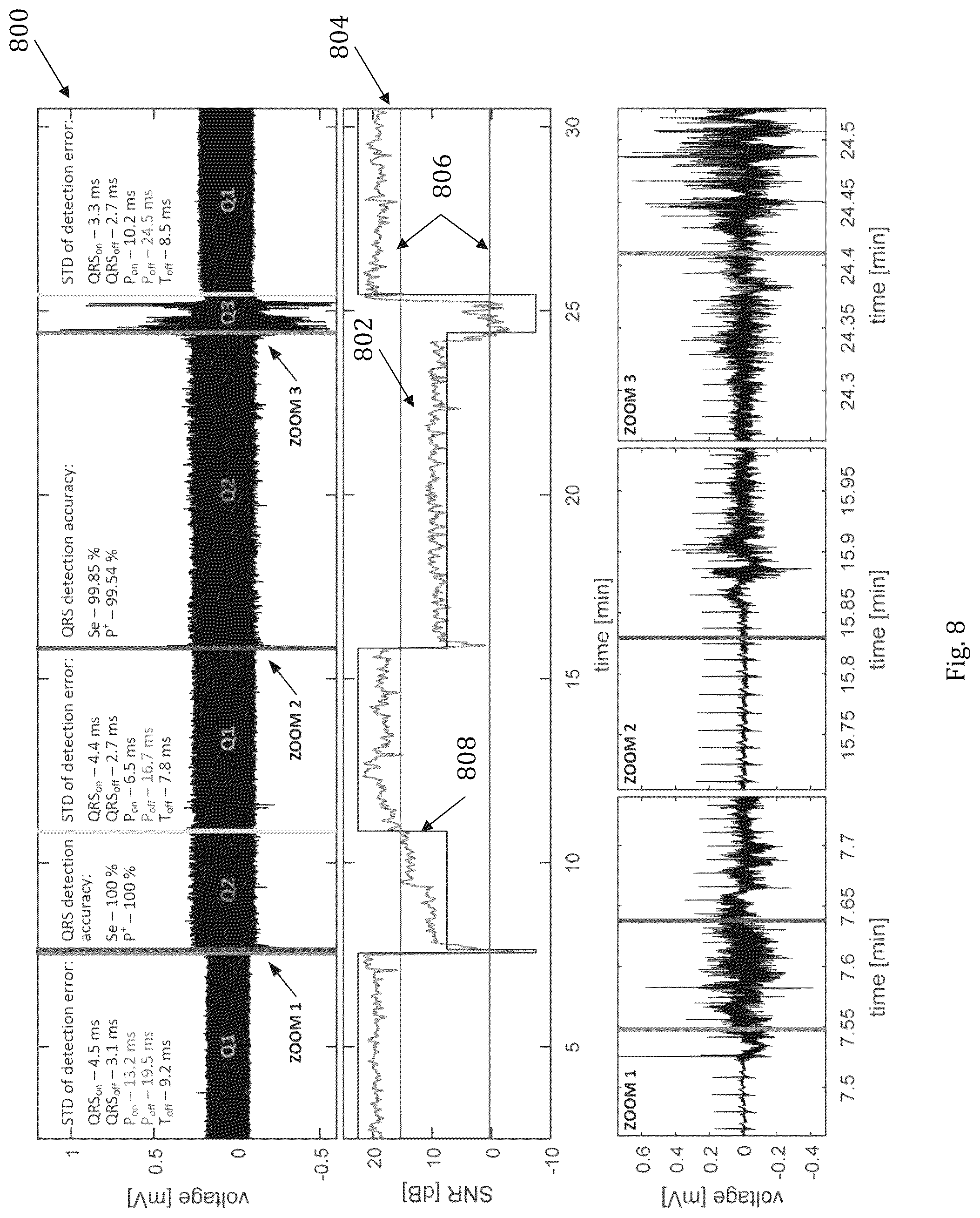 Patent US12102450 Figure 7 – System and method for assessing physiological signal quality