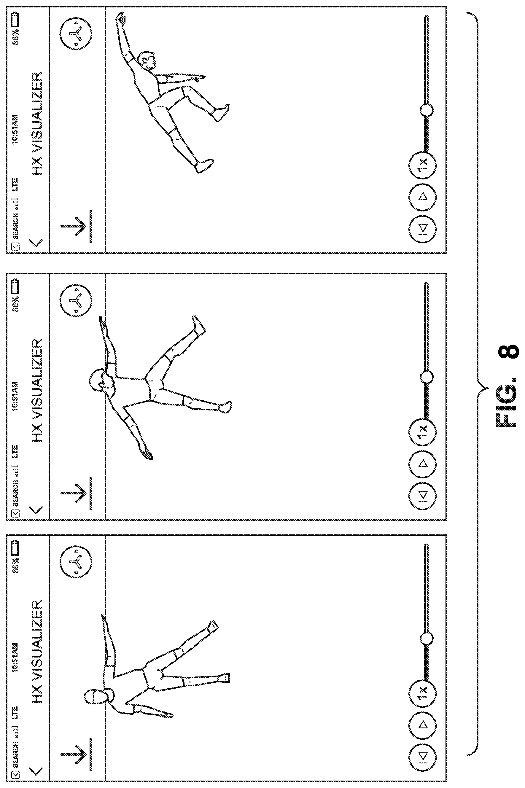 Patent US12102453 Figure 8 – Means and method for reducing lower body extremity injuries
