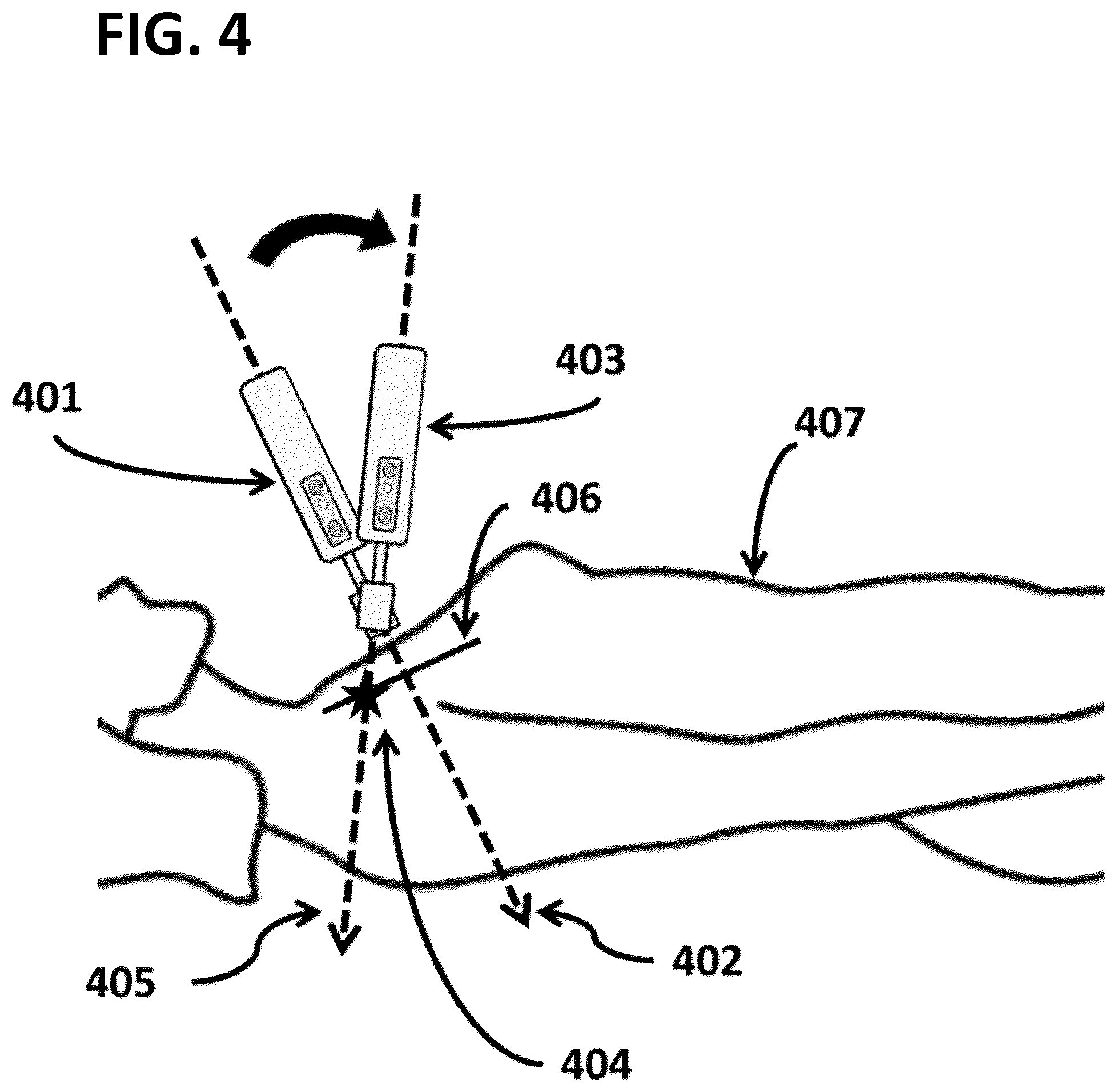 Patent US12102461 Figure 4 – Intraoperative radiation probe system with radiation-orientation mapping