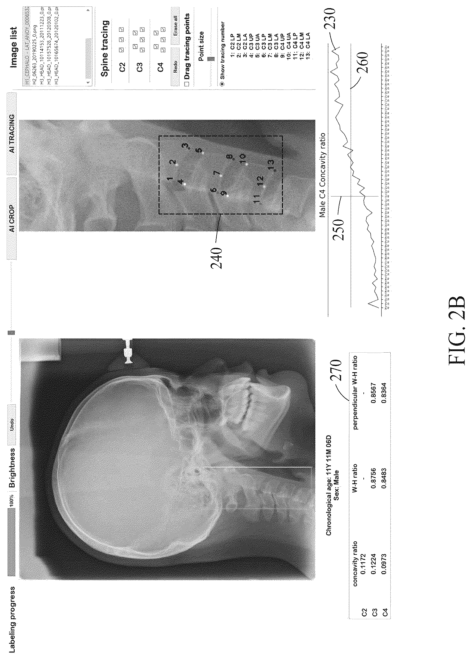 Patent US12102464 Figure 3 – Bone age estimation method and apparatus