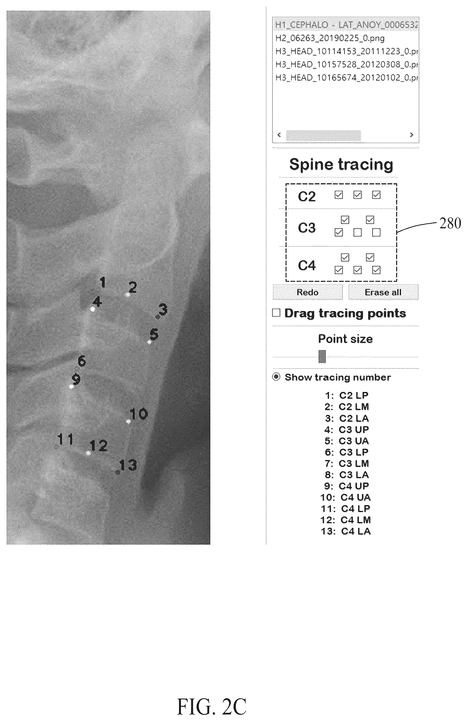 Patent US12102464 Figure 4 – Bone age estimation method and apparatus