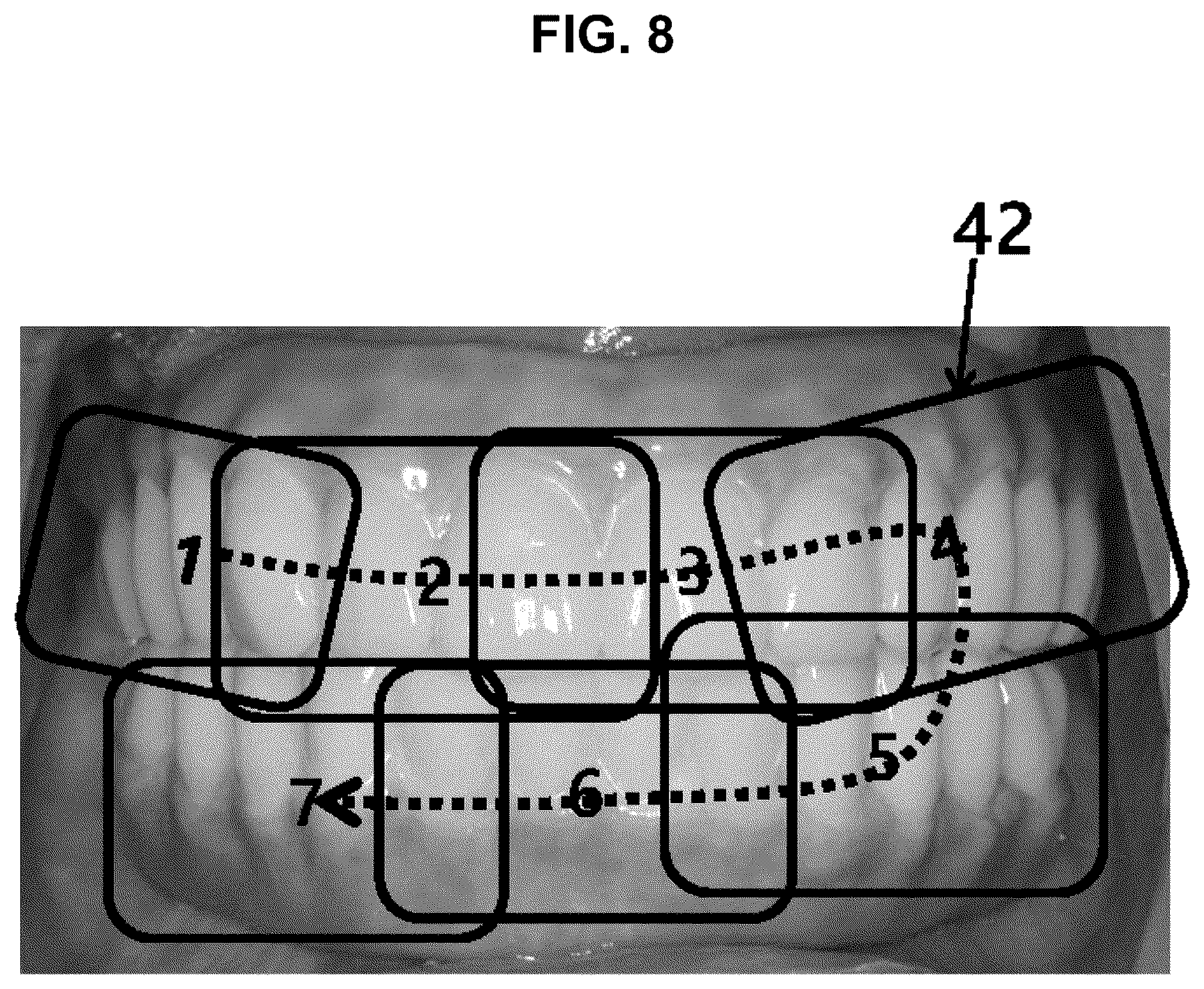 Patent US12102465 Figure 8 – Three-dimensional scanner and scanning method using same