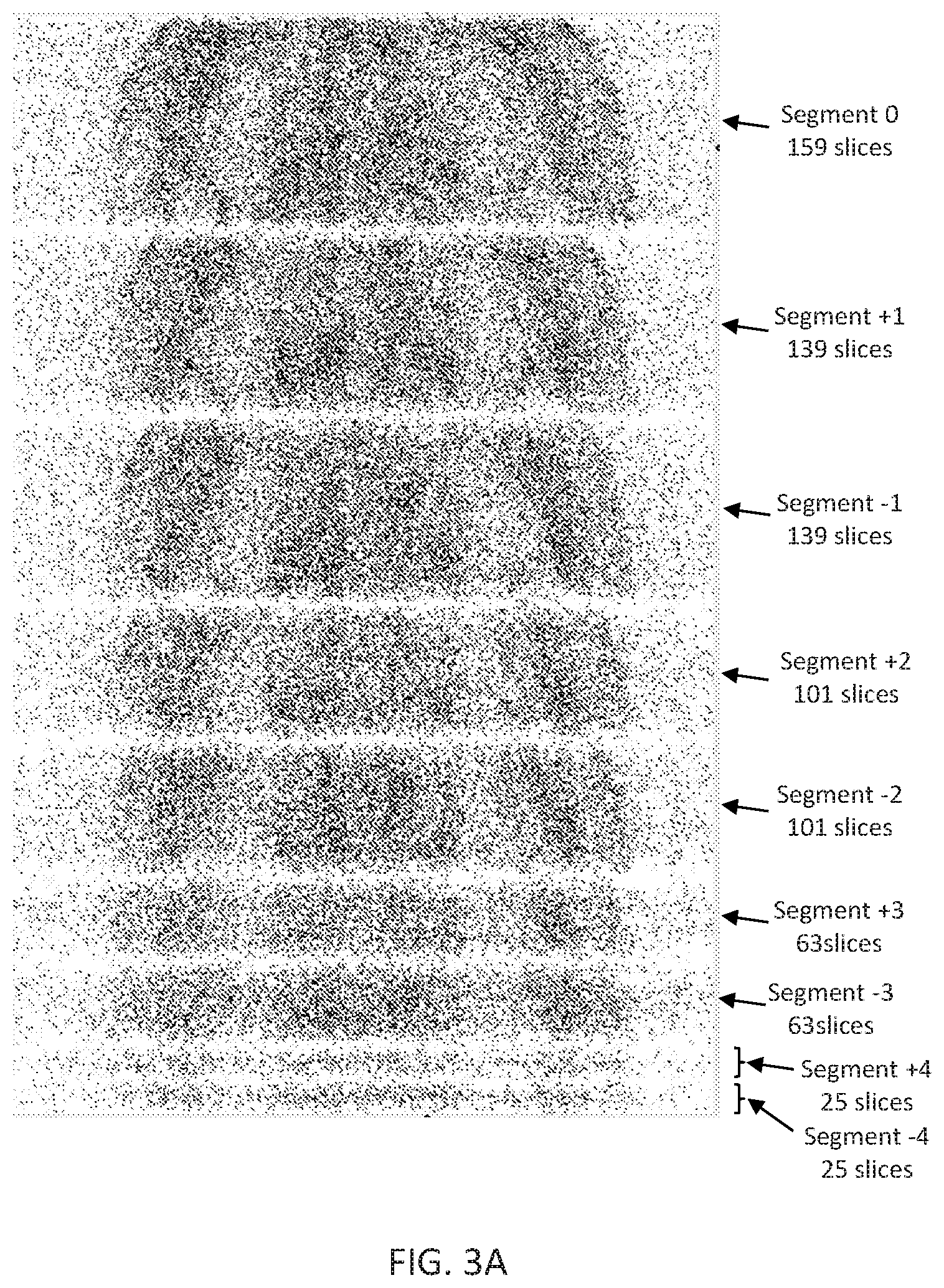 Patent US12102466 Figure 4 – Pet imaging using multiple organ specific short CT scans