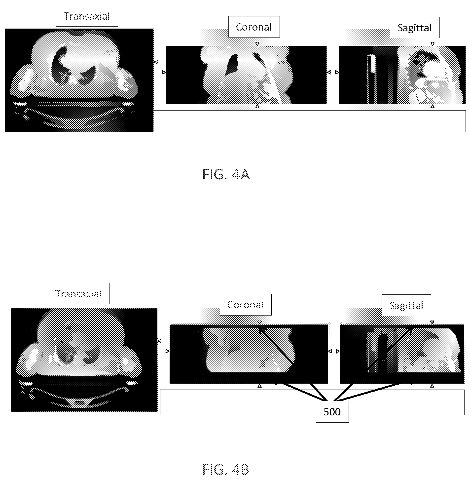 Patent US12102466 Figure 6 – Pet imaging using multiple organ specific short CT scans