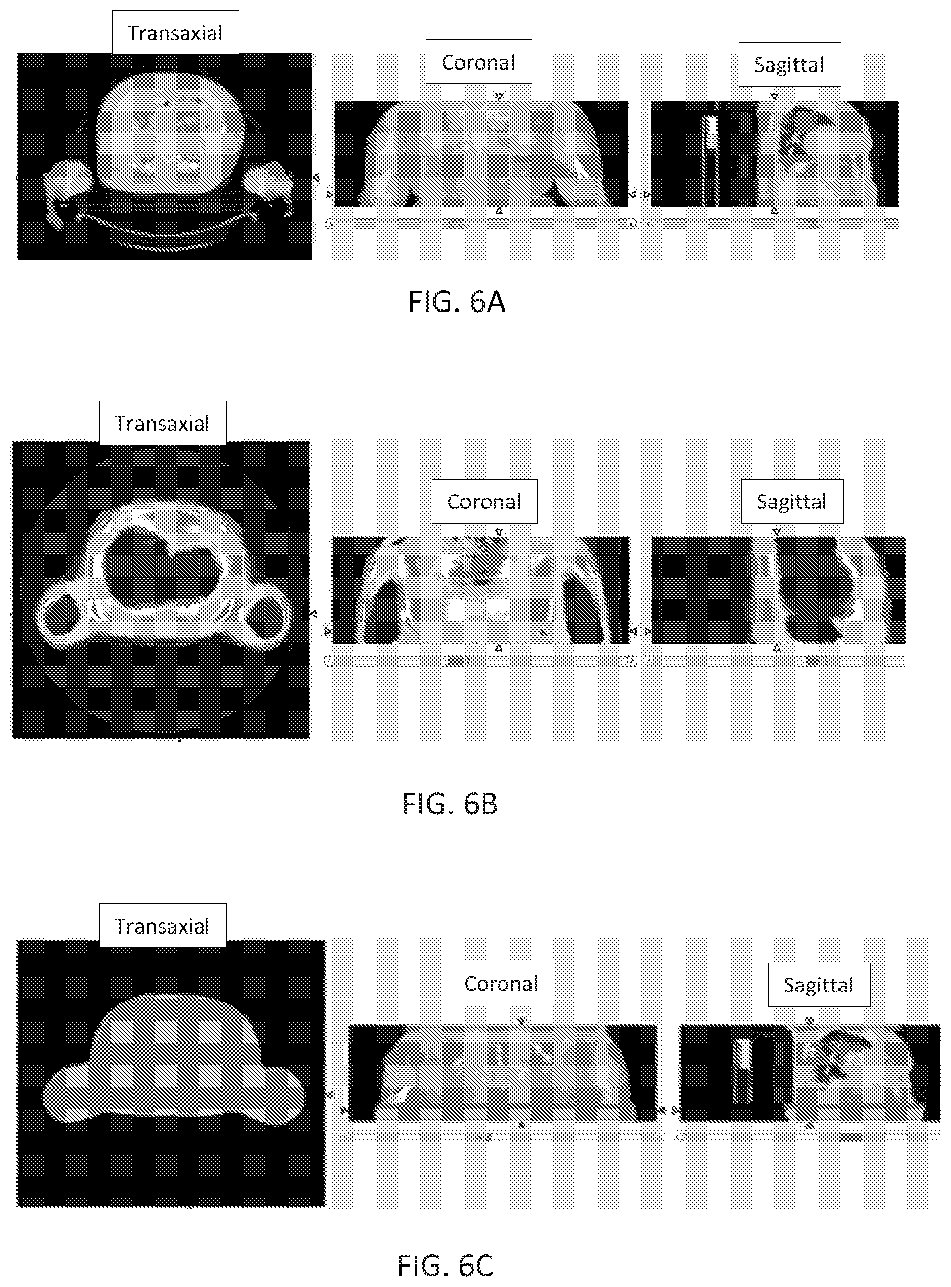 Patent US12102466 Figure 8 – Pet imaging using multiple organ specific short CT scans