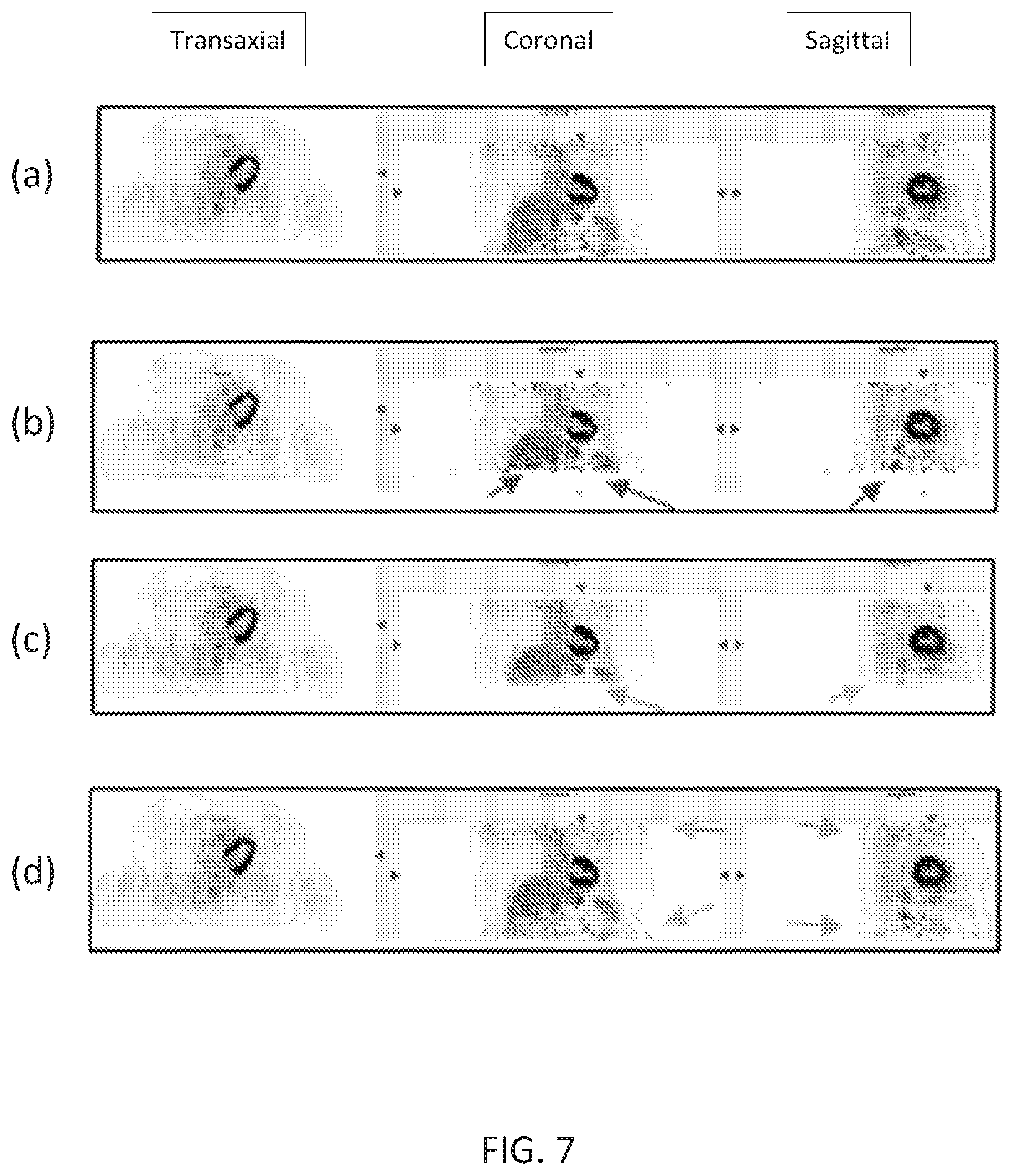 Patent US12102466 Figure 9 – Pet imaging using multiple organ specific short CT scans