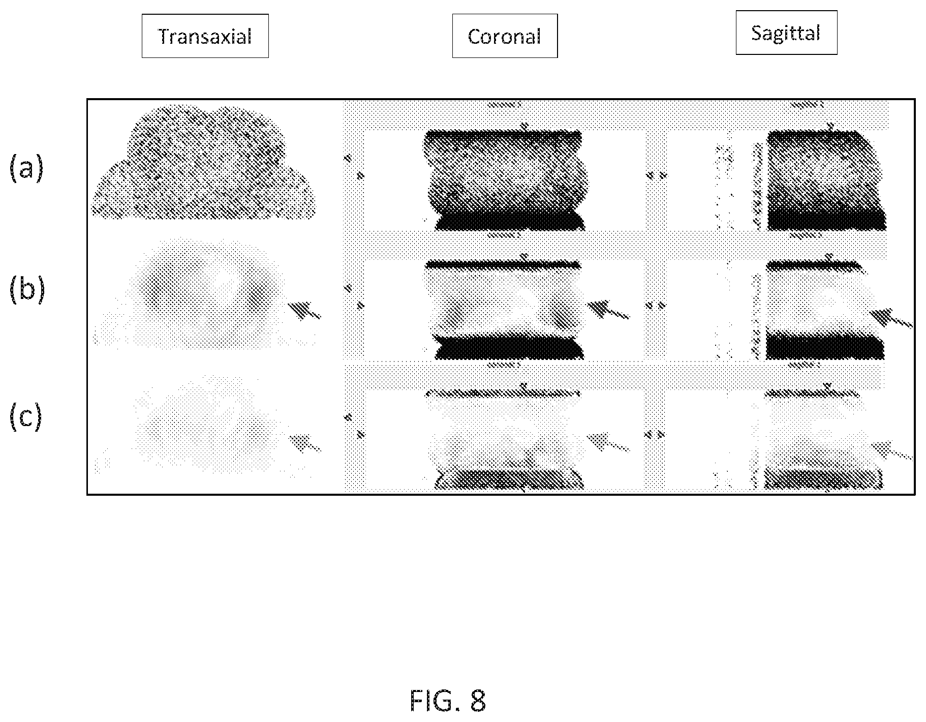Patent US12102466 Figure 10 – Pet imaging using multiple organ specific short CT scans