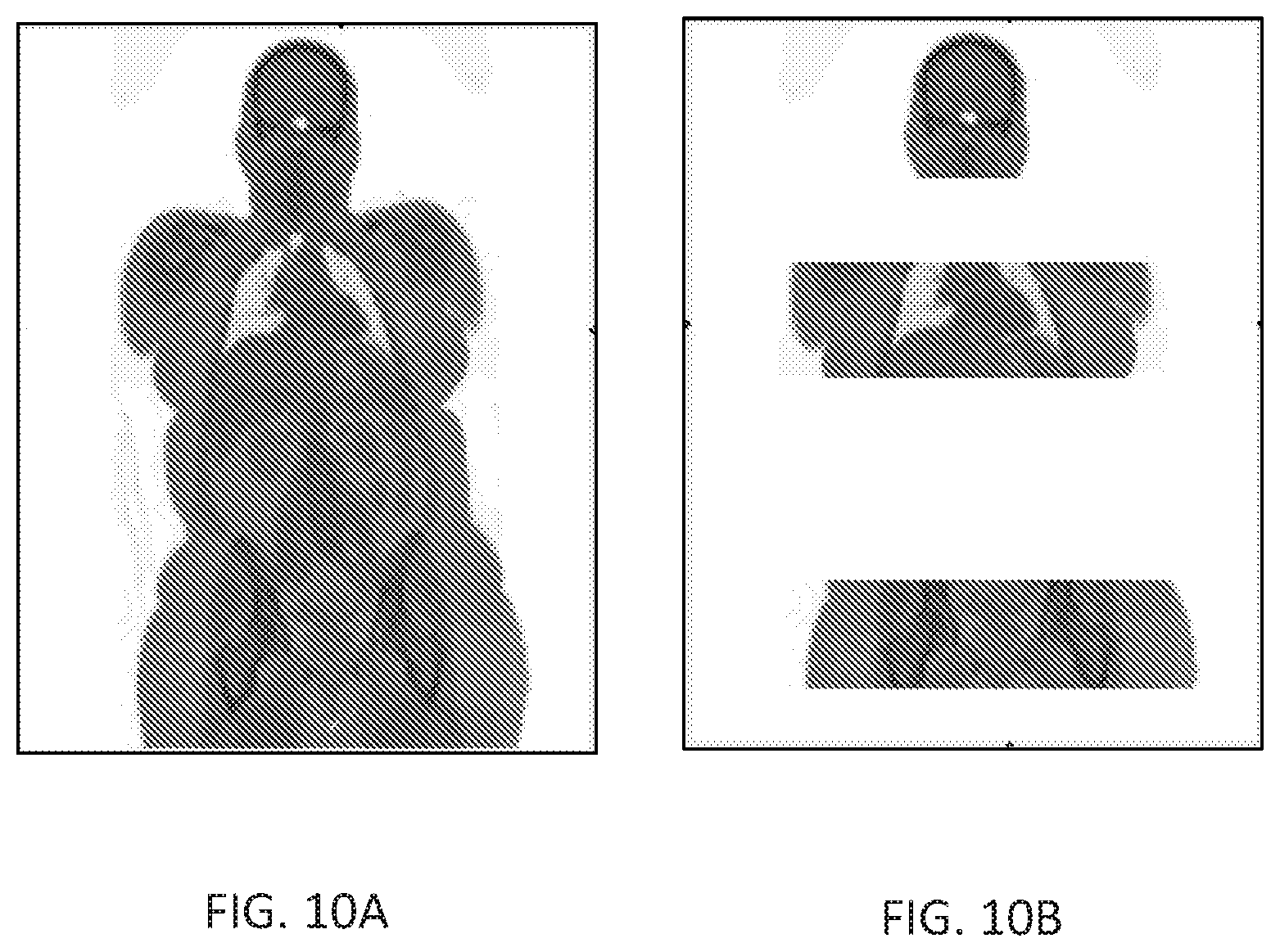 Patent US12102466 Figure 14 – Pet imaging using multiple organ specific short CT scans